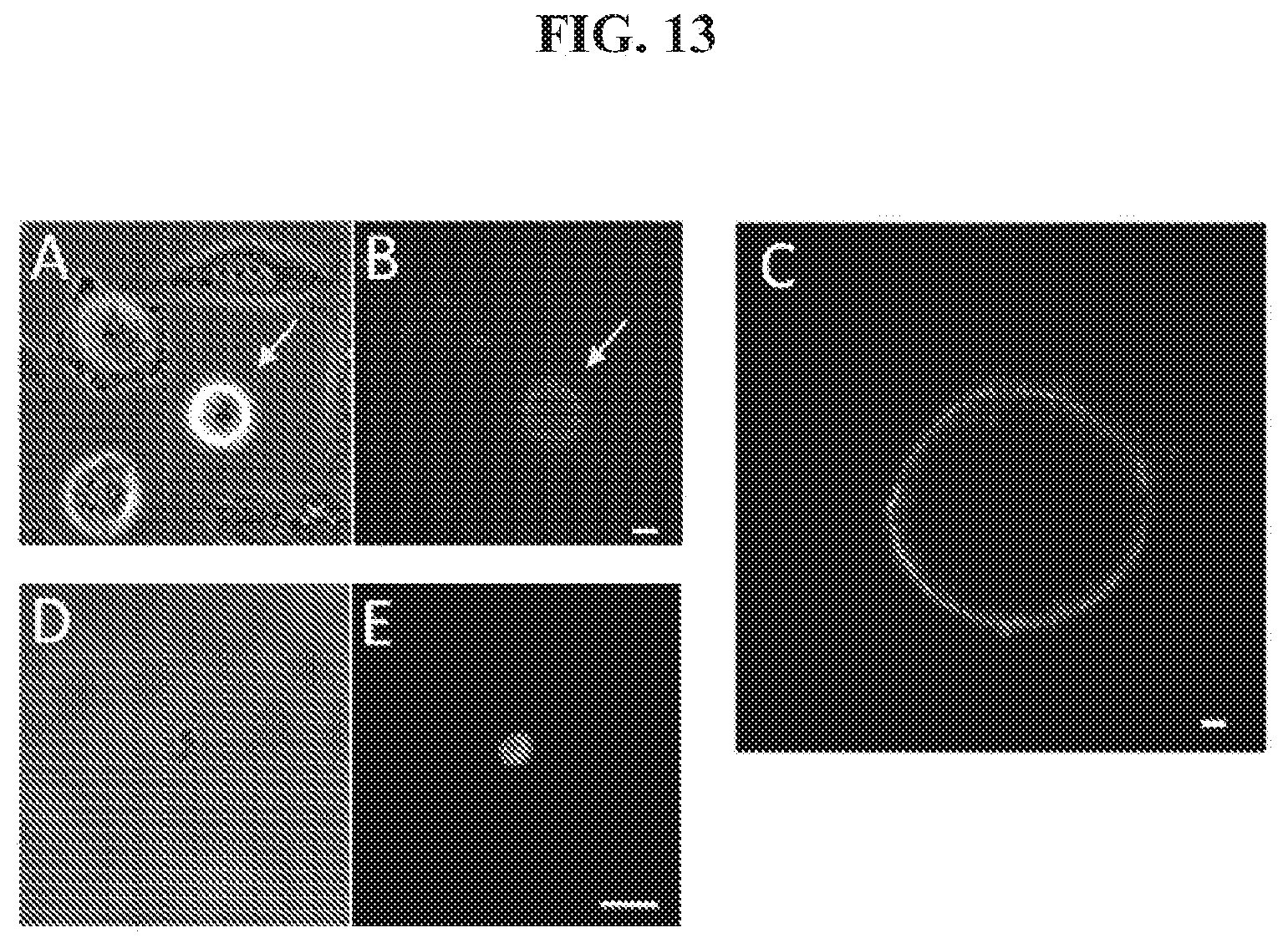 Patent US12174205 Figure 13 – Phosphatidylethanolamine-specific probes