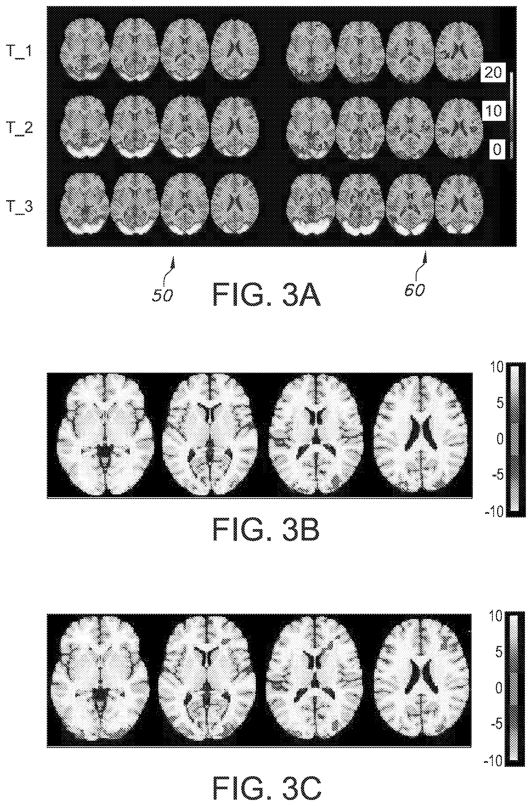 Patent US12174278 Figure 4 – fMRI imaging
