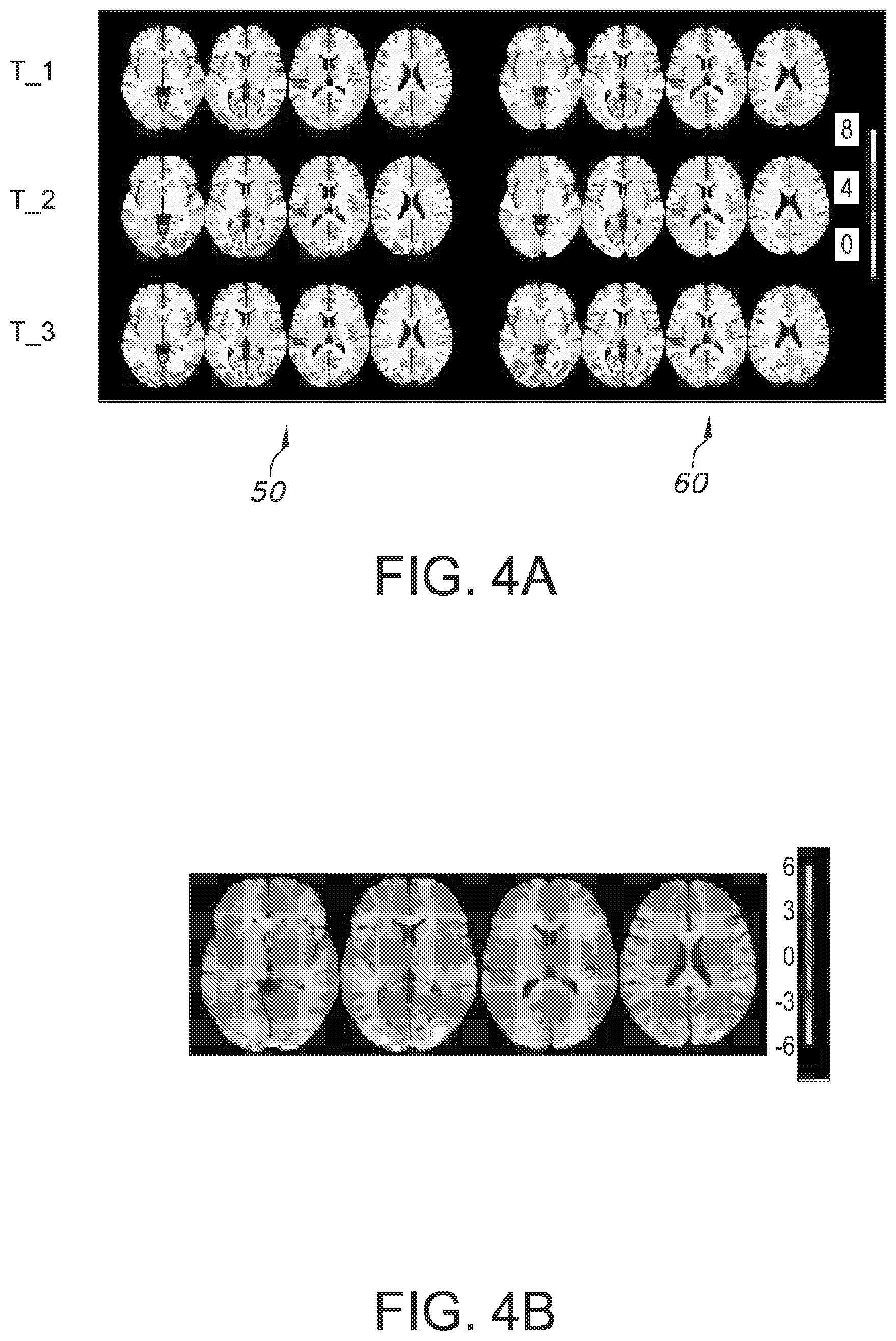 Patent US12174278 Figure 5 – fMRI imaging