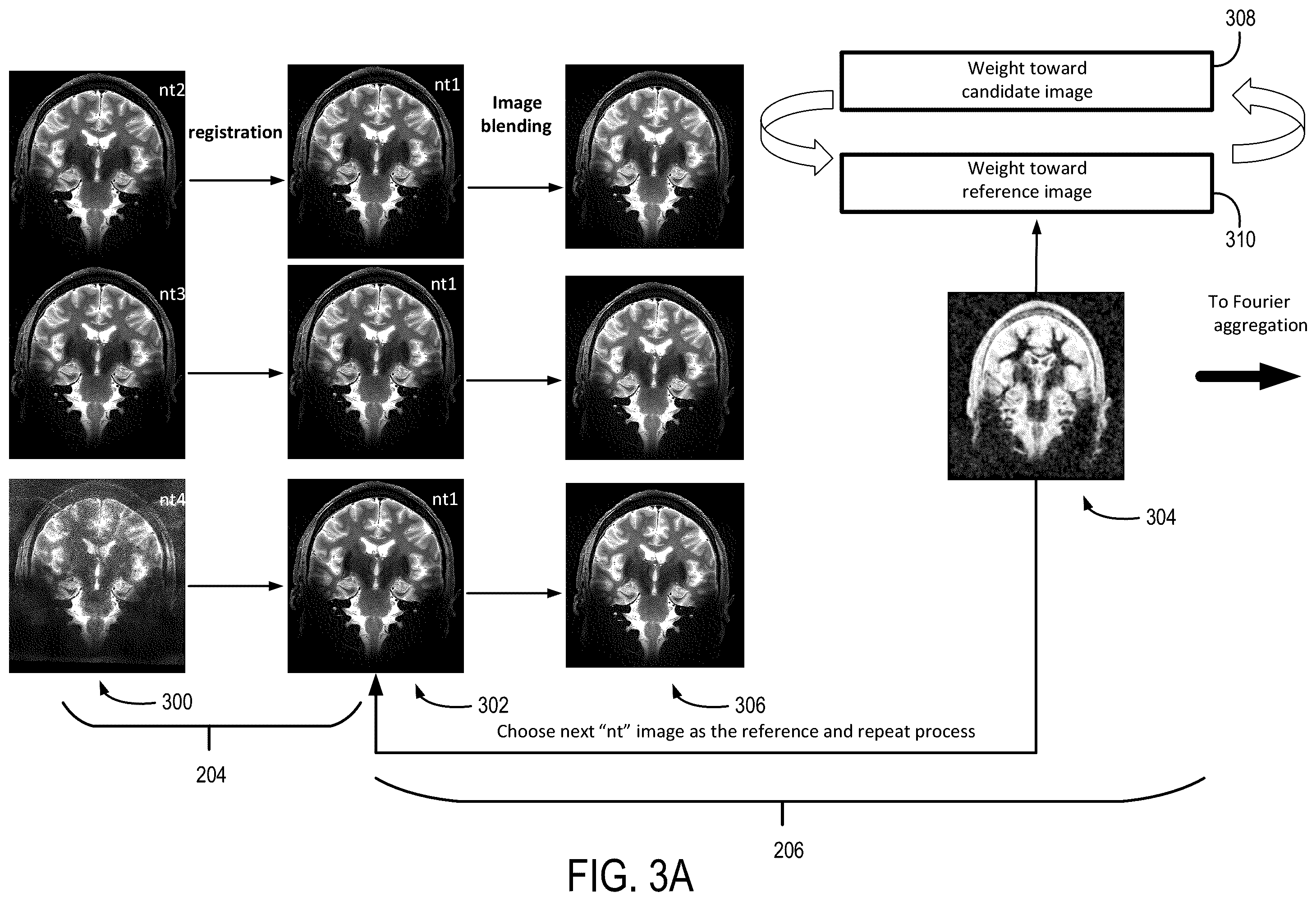Patent US12174281 Figure 3 – System and method for control of motion in medical images using aggregation