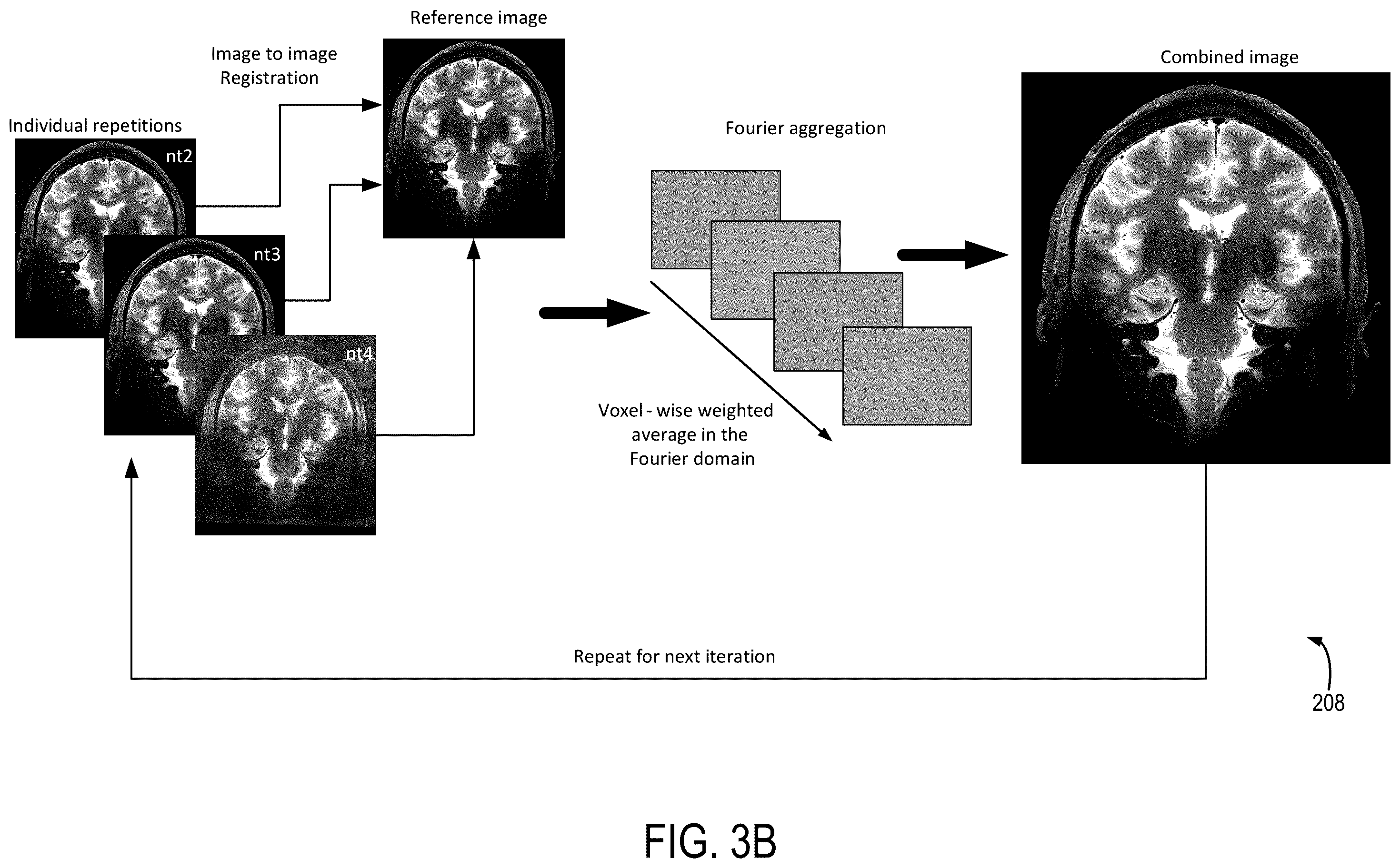 Patent US12174281 Figure 4 – System and method for control of motion in medical images using aggregation