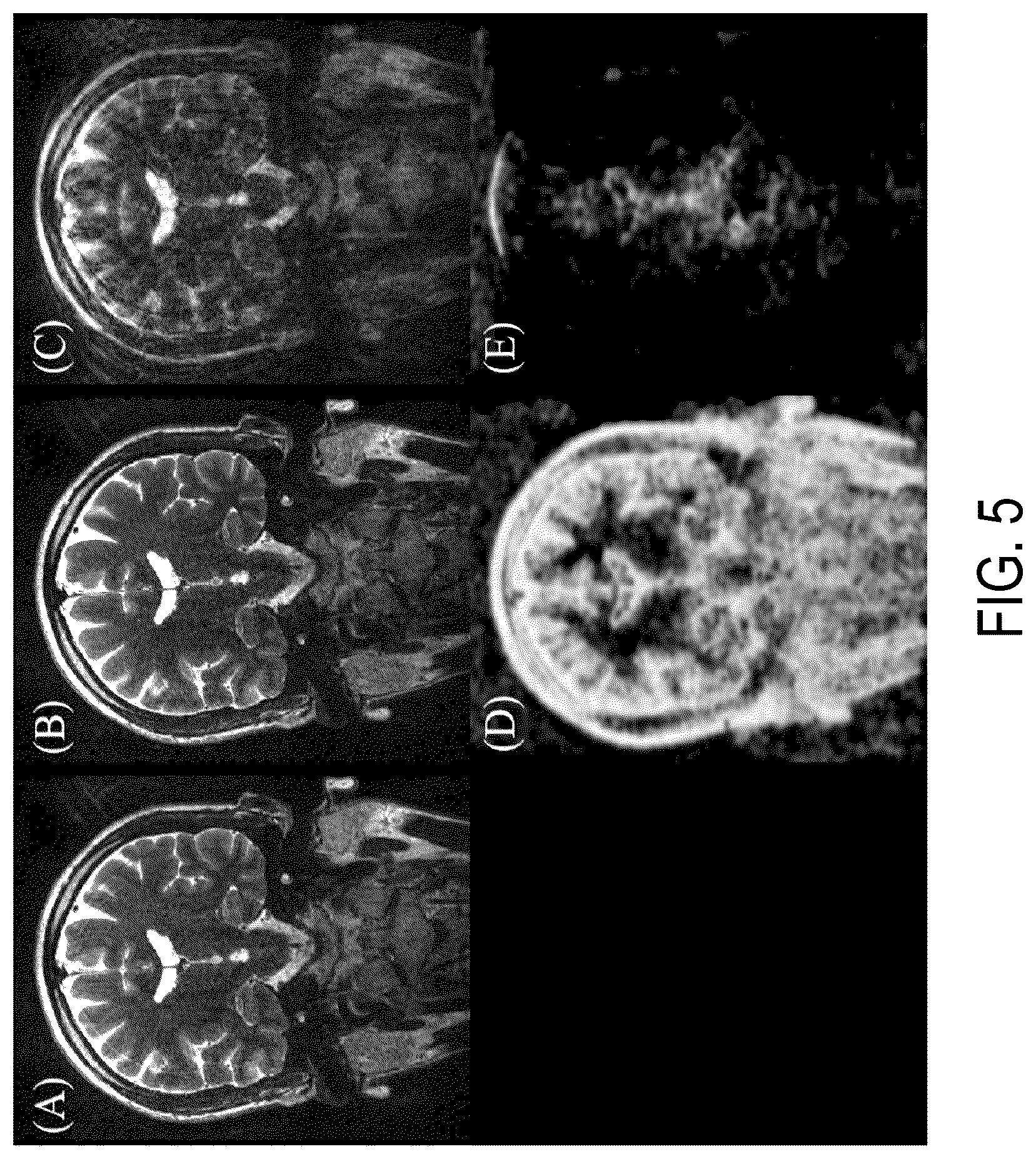 Patent US12174281 Figure 6 – System and method for control of motion in medical images using aggregation