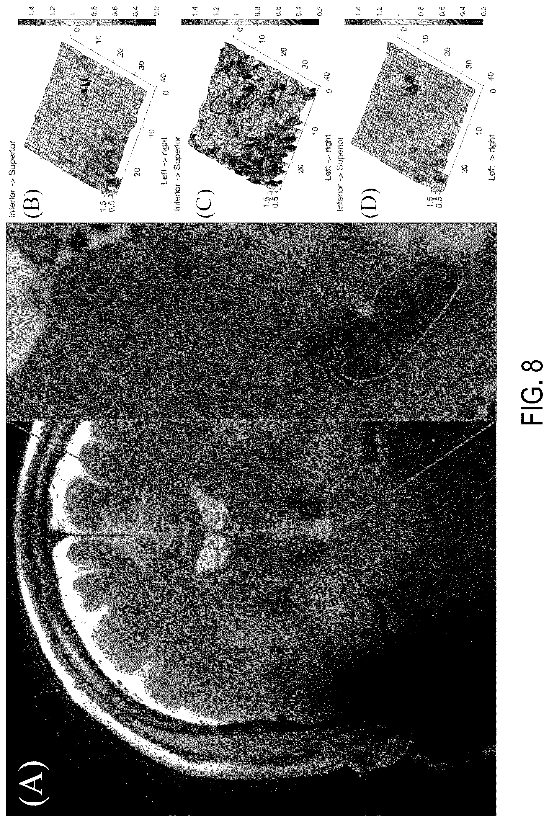 Patent US12174281 Figure 9 – System and method for control of motion in medical images using aggregation
