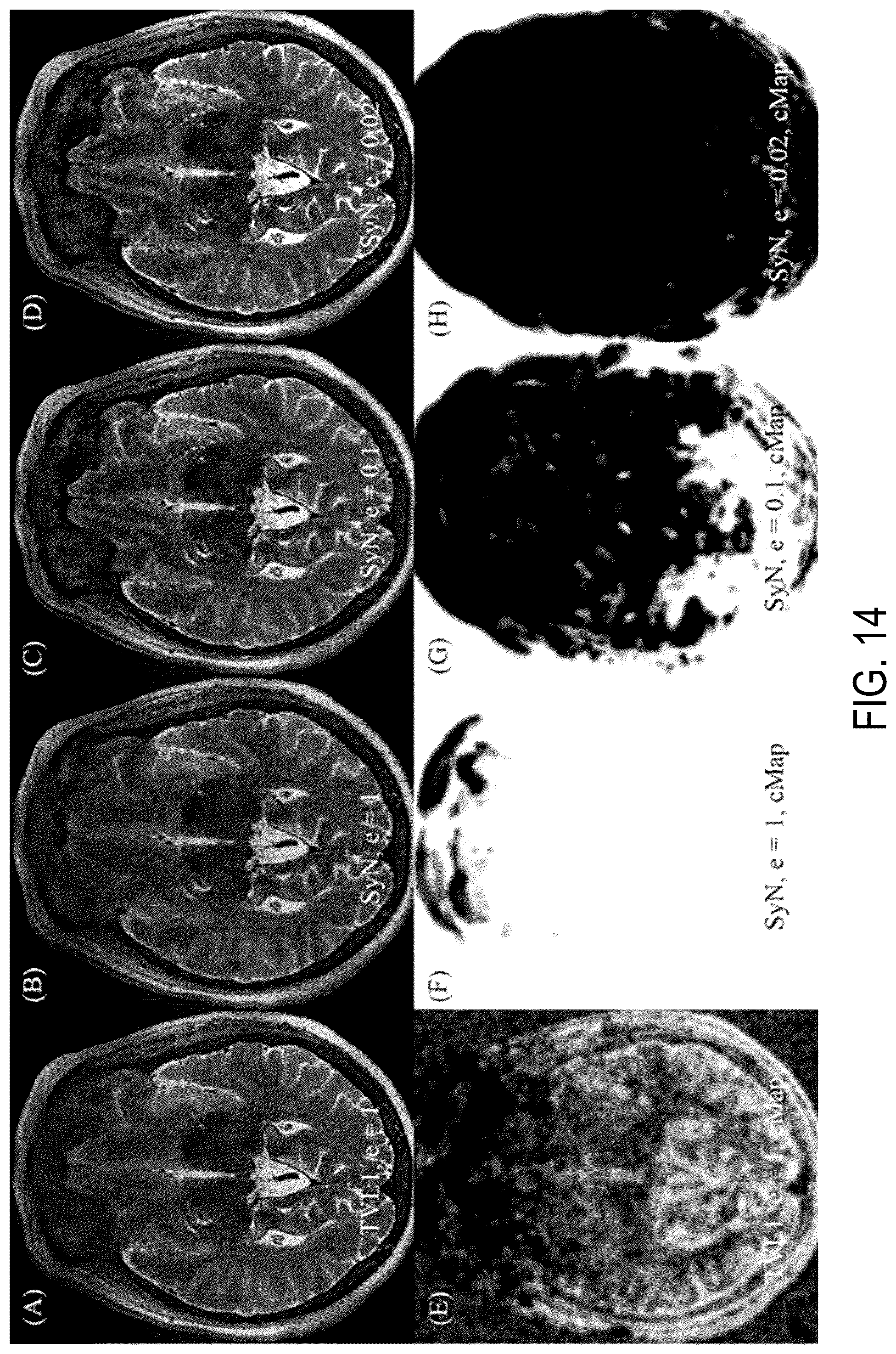 Patent US12174281 Figure 15 – System and method for control of motion in medical images using aggregation
