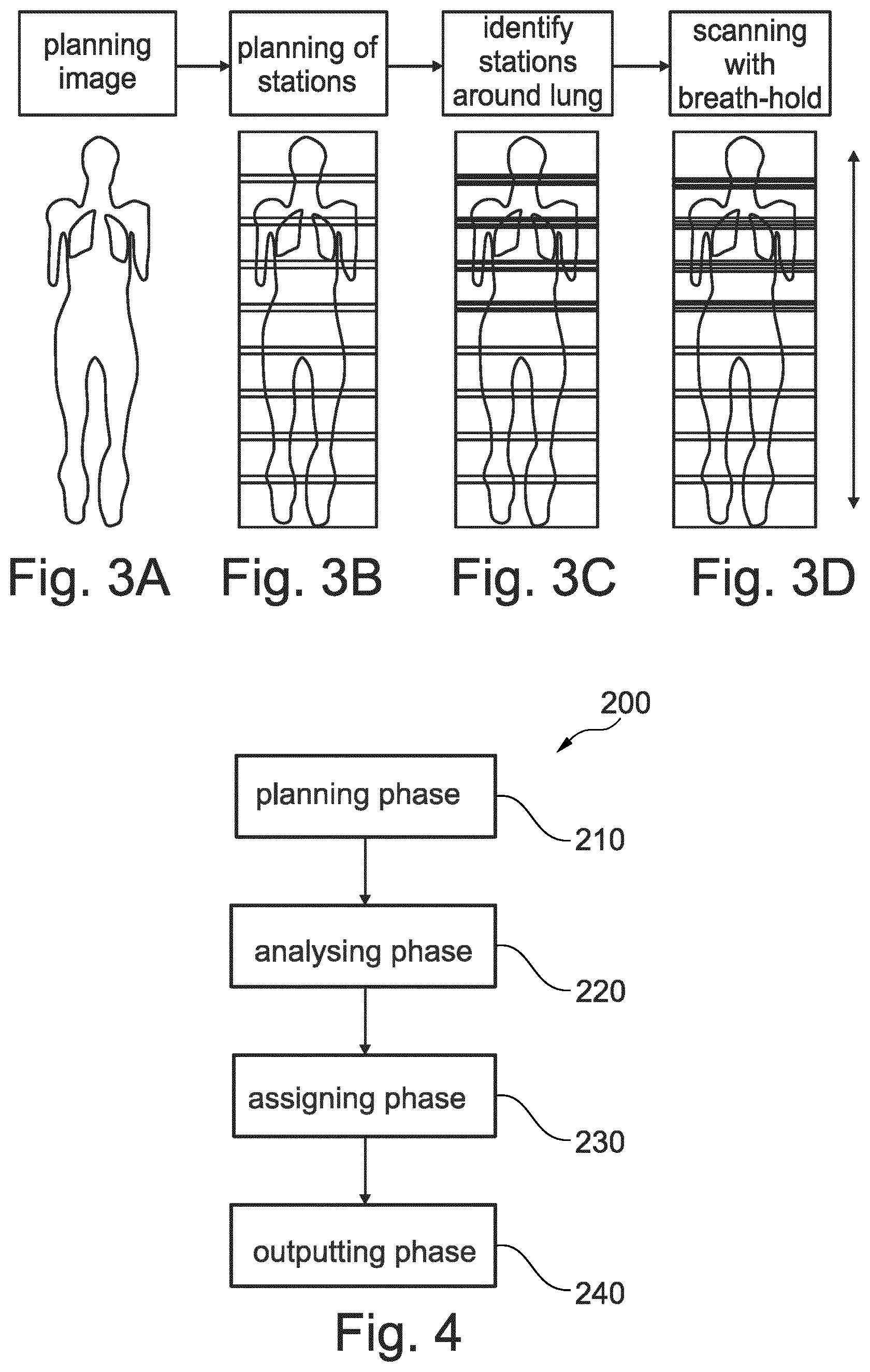 Patent US12174282 Figure 2 – Automated detection of critical stations in multi-station magnetic resonance imaging