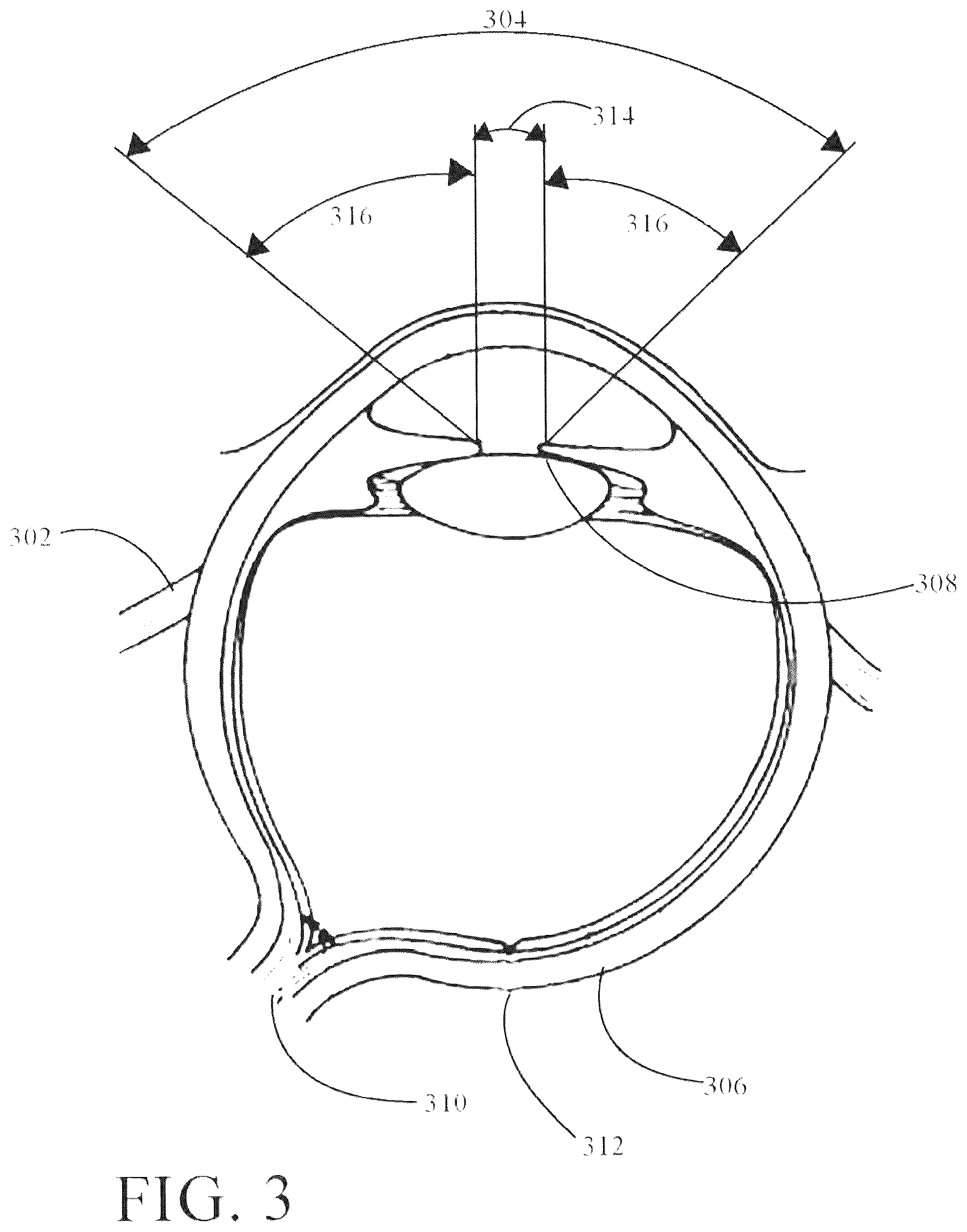 Patent US12174383 Figure 3 – System for and method of projecting augmentation imagery in a head-mounted display