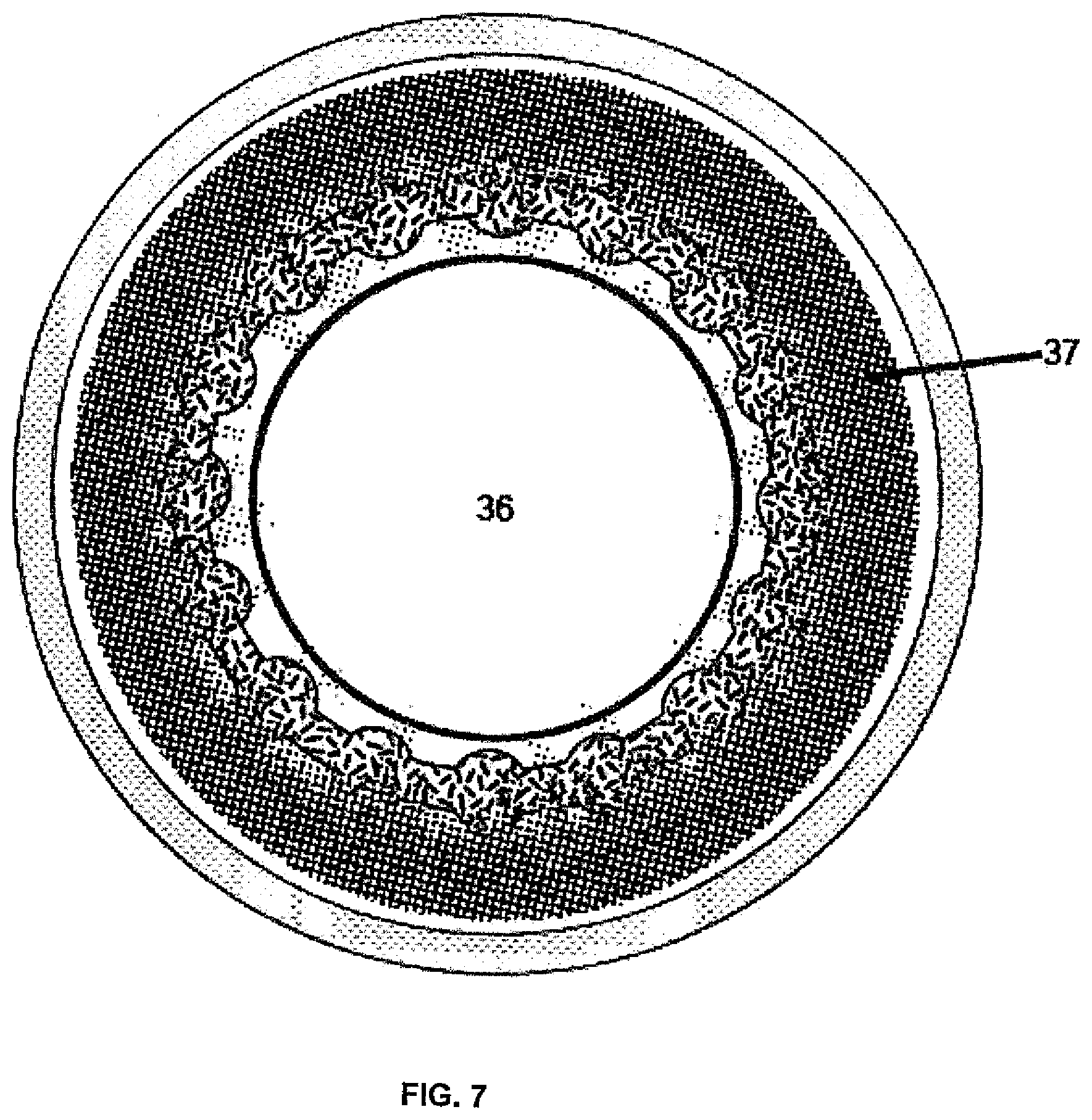 Patent US12174462 Figure 7 – Cosmetic functional contact lens