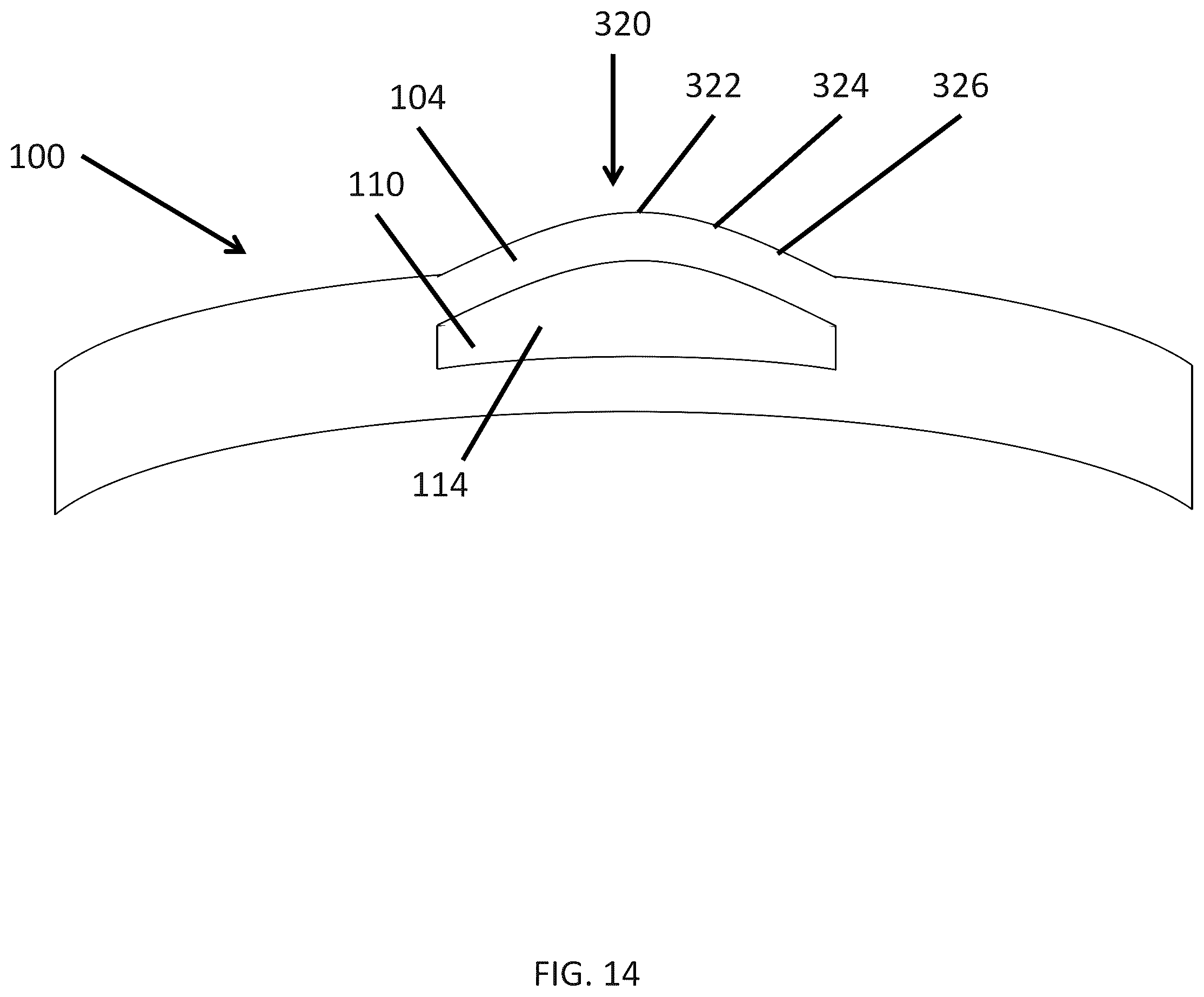 Patent US12174463 Figure 17 – Accommodating lens with cavity