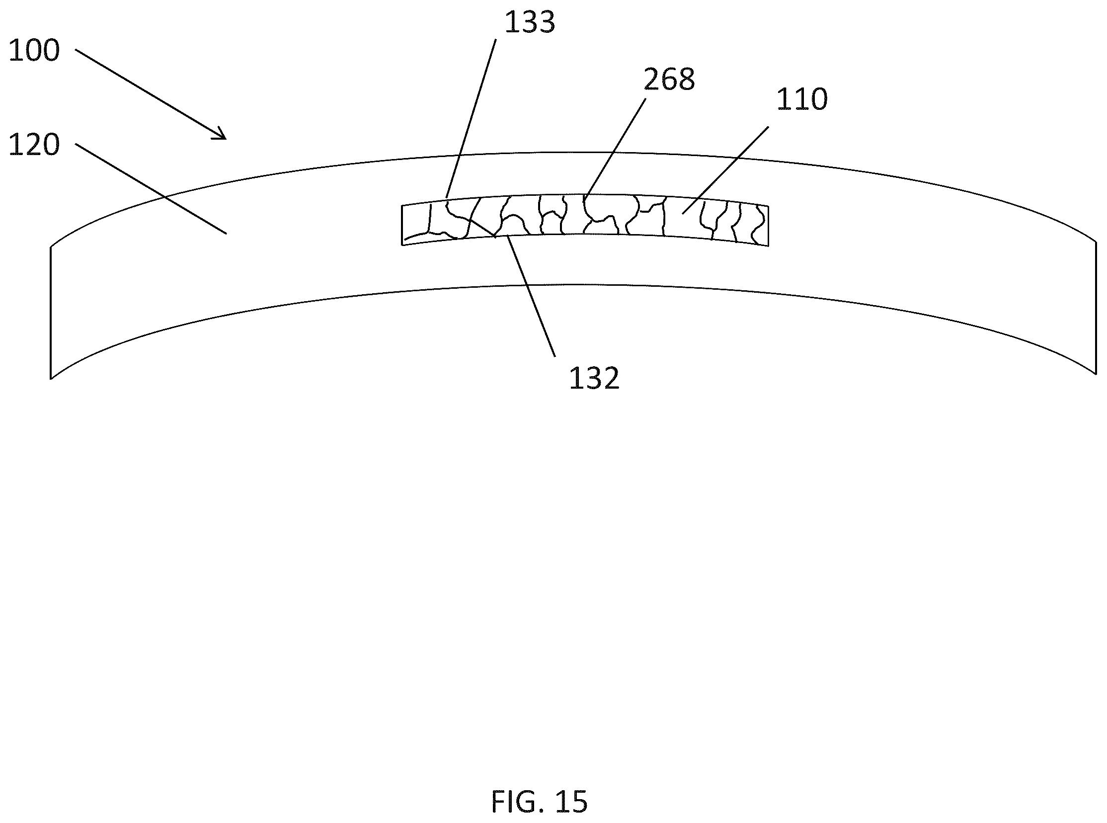 Patent US12174463 Figure 18 – Accommodating lens with cavity