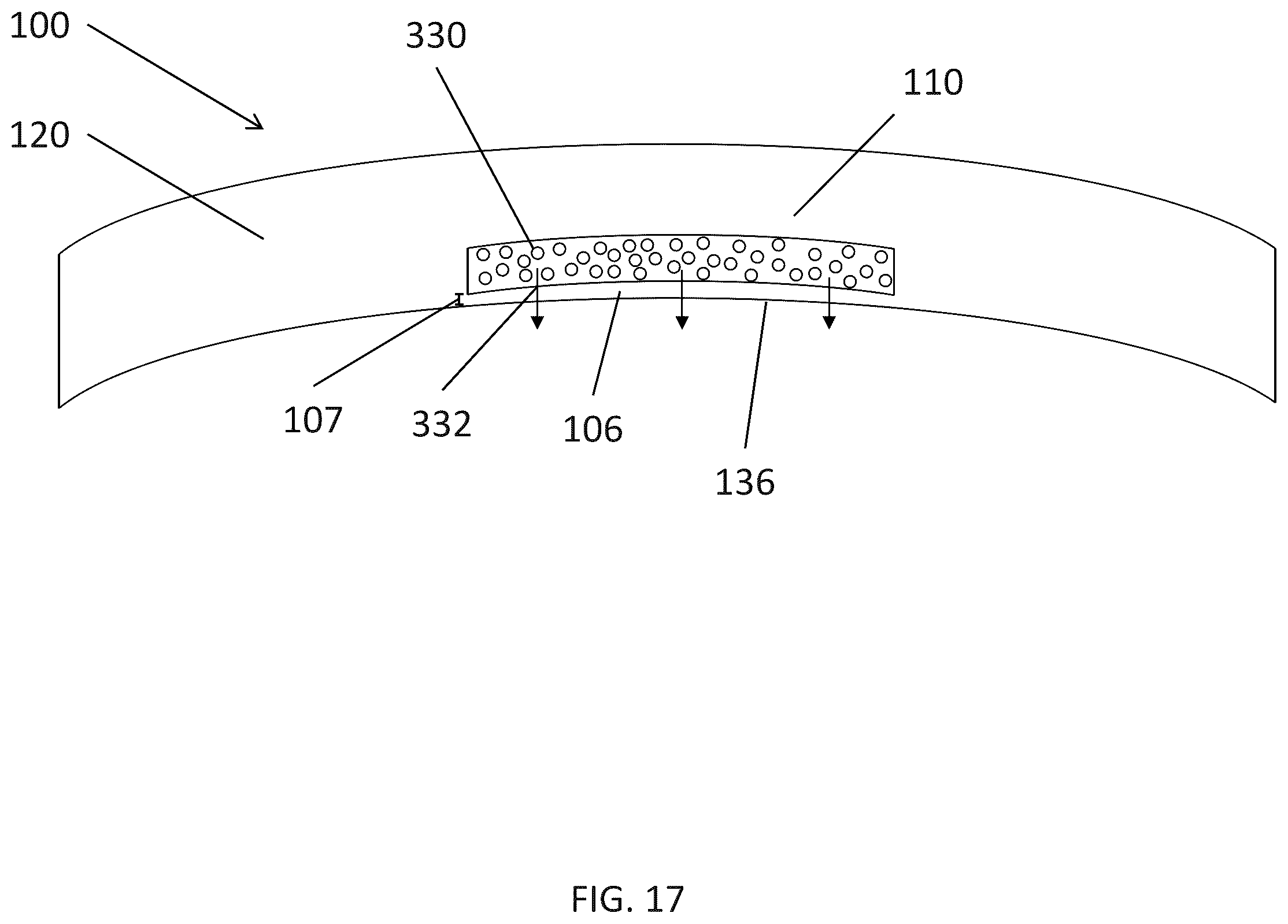 Patent US12174463 Figure 20 – Accommodating lens with cavity