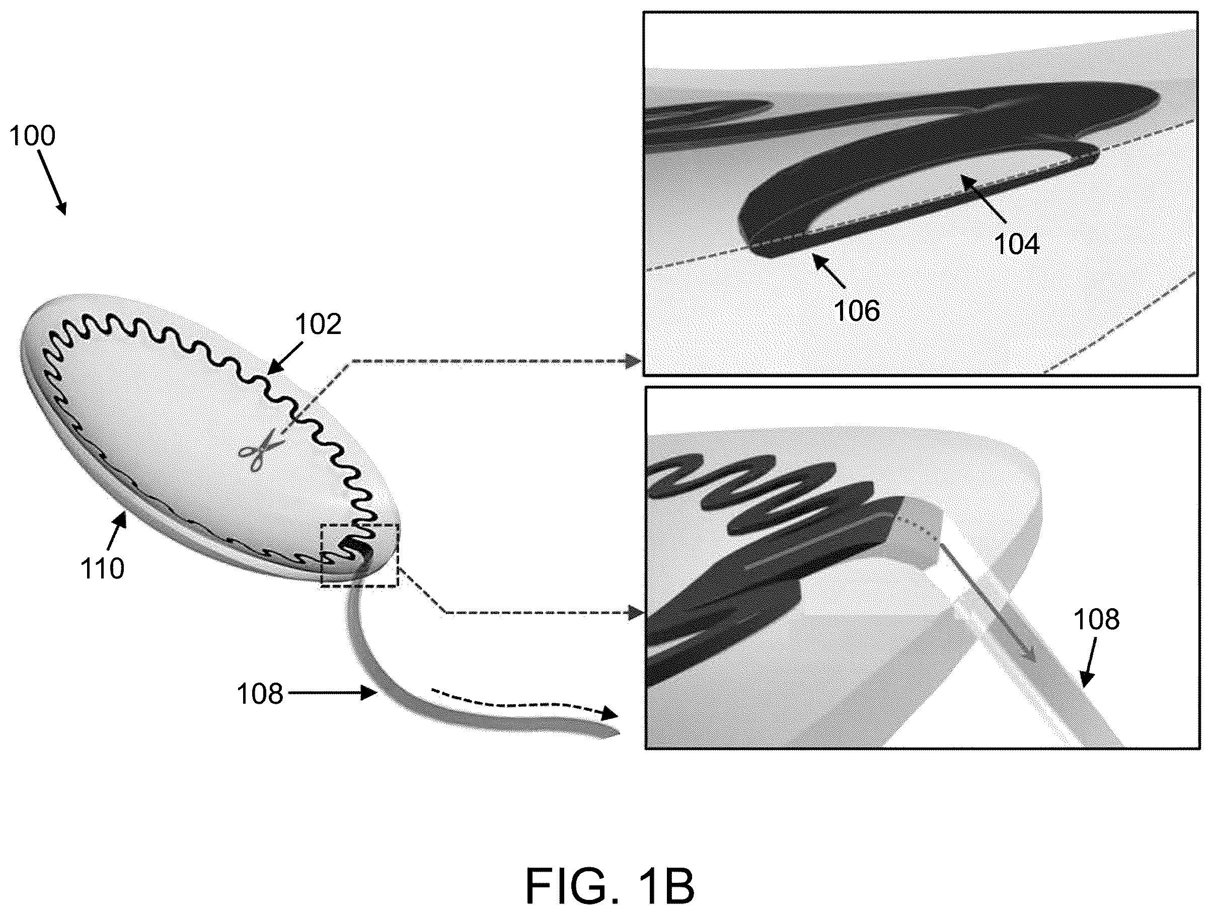 Patent US12174464 Figure 2 – Contact lens having sensors and methods for producing the same