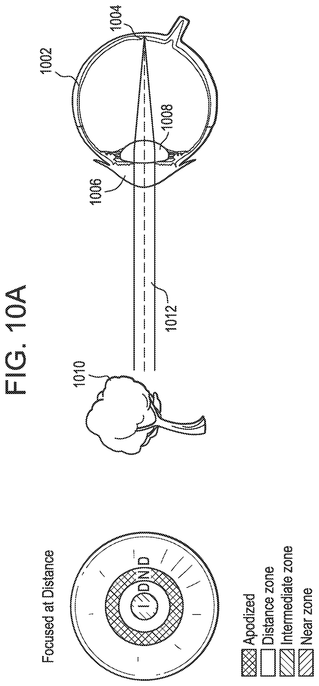 Patent US12174465 Figure 11 – Dynamically tunable apodized multiple-focus opthalmic devices and methods