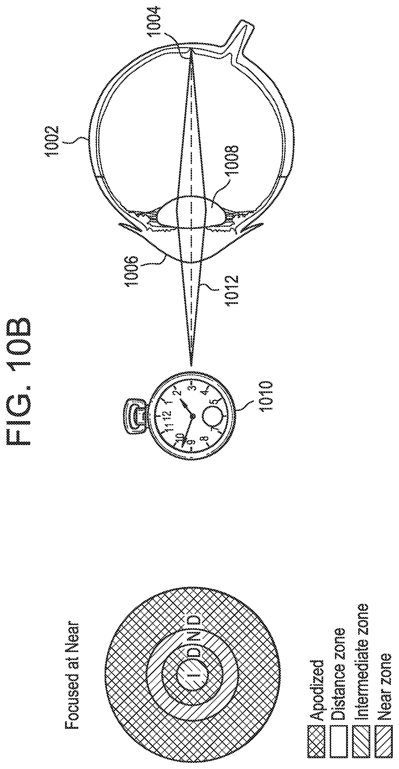 Patent US12174465 Figure 12 – Dynamically tunable apodized multiple-focus opthalmic devices and methods