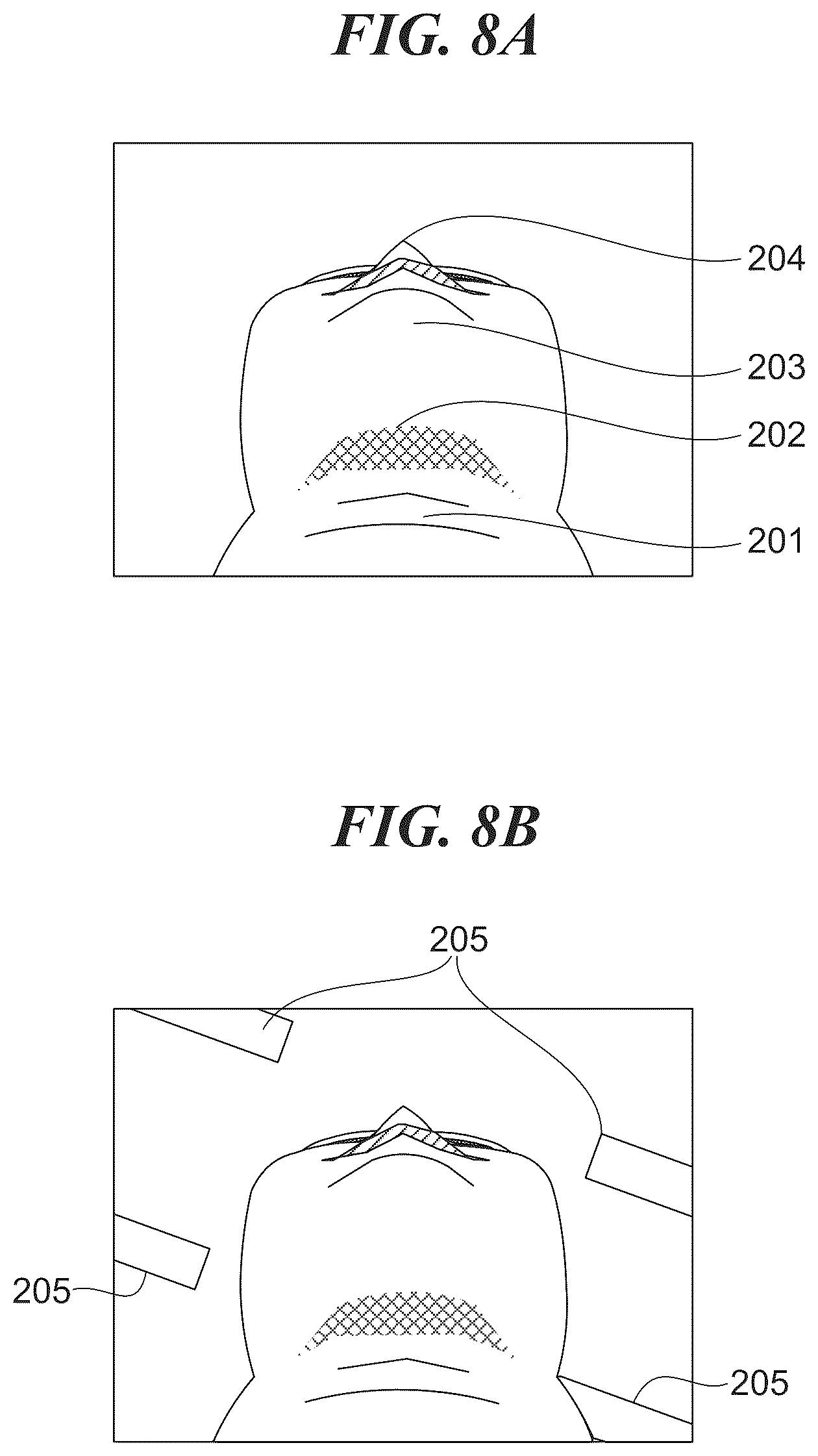 Patent US12174661 Figure 18 – Wearable image pickup apparatus, portable device and calibrator that communicate with image pickup apparatus, control methods therefor, and storage media storing control programs therefor