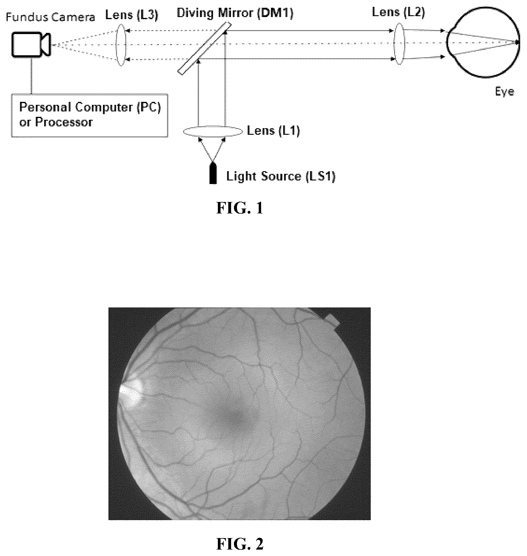 Patent US12184981 Figure 1 – Optical system for real-time closed-loop control of fundus camera and implementation method therefor