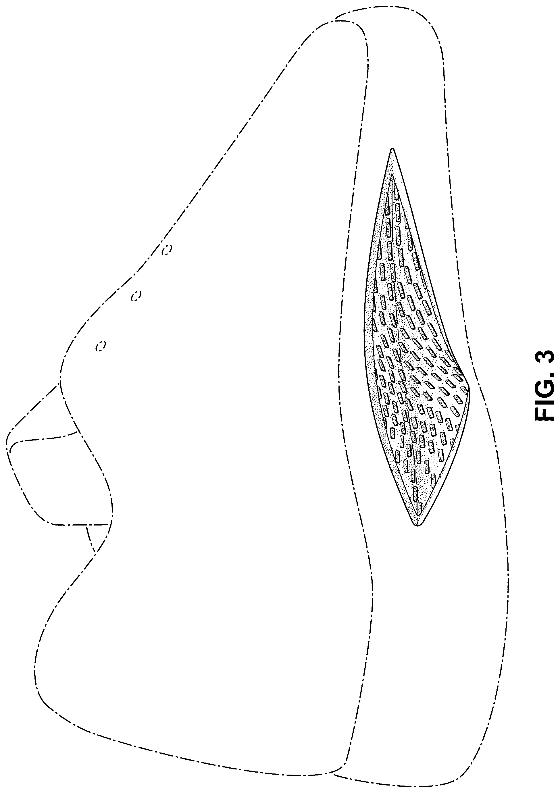 Patent USD1043069 Figure 3 – Shoe