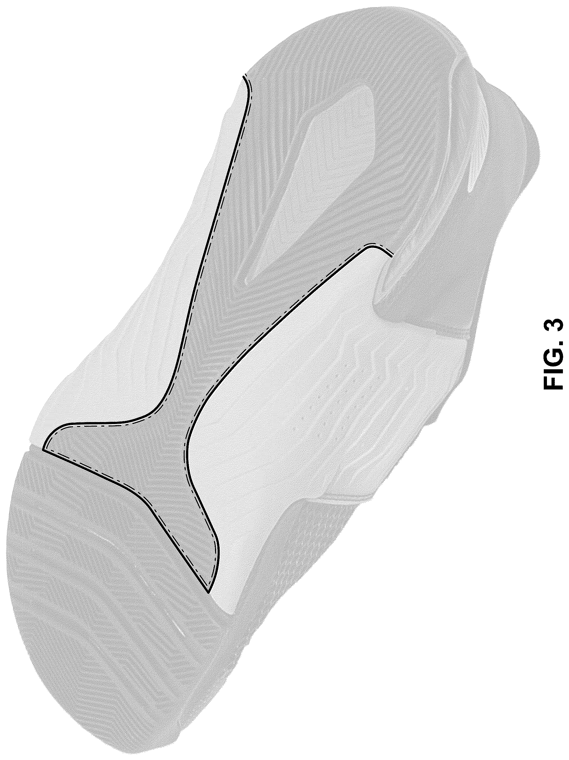 Patent USD1043070 Figure 3 – Shoe