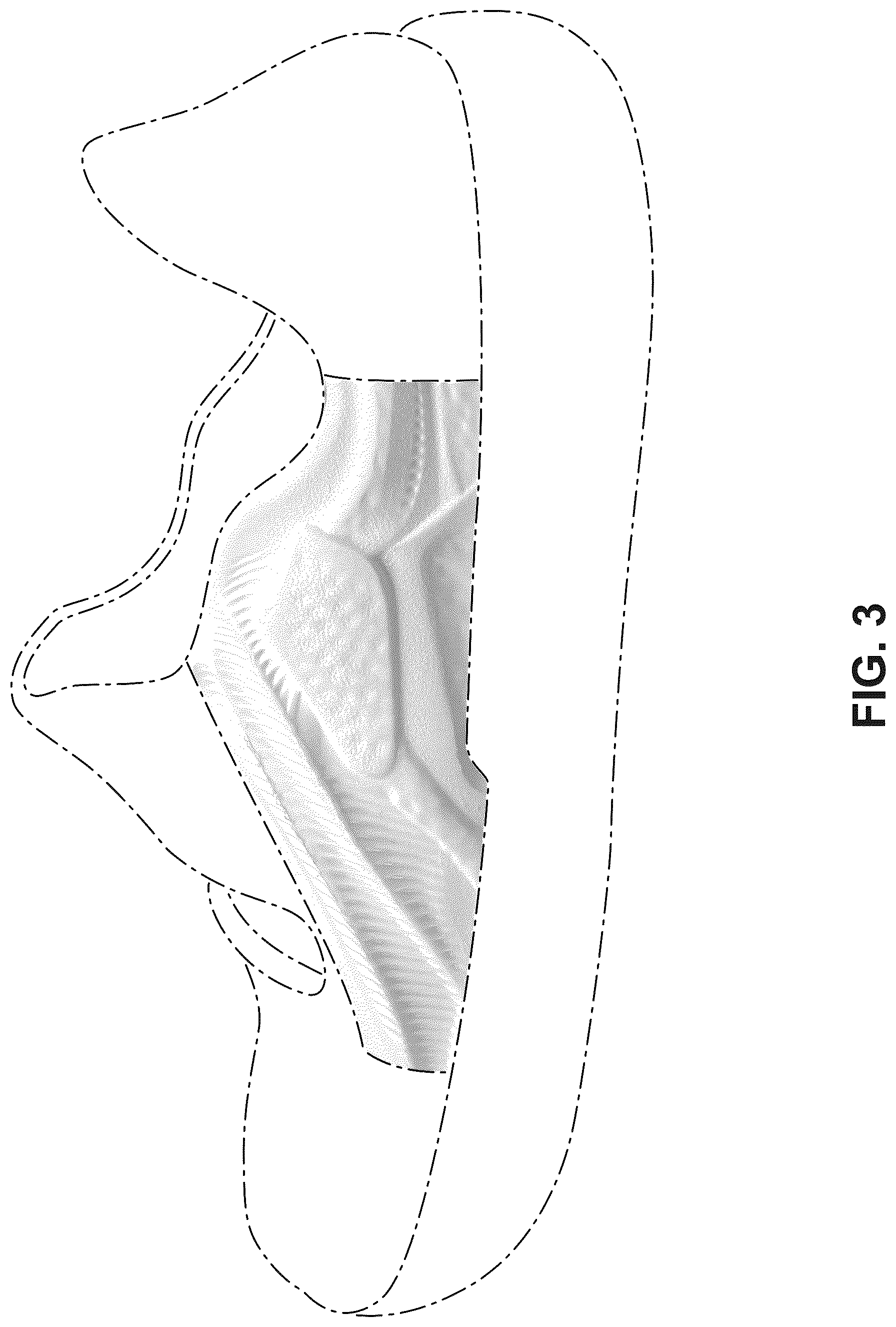 Patent USD1043087 Figure 3 – Shoe