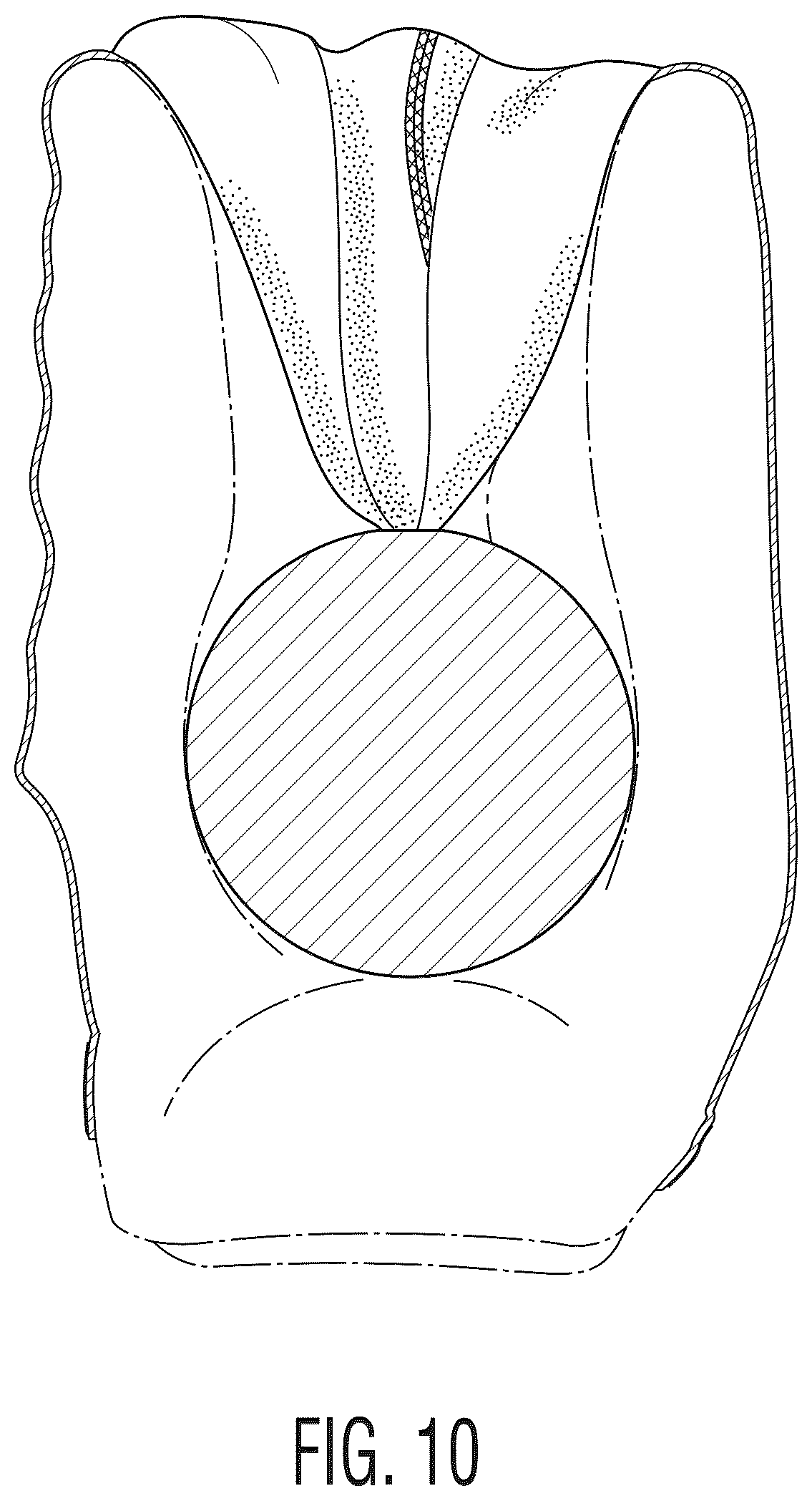 Patent USD1043879 Figure 9 – Baseball glove protector and pocket shaper apparatus