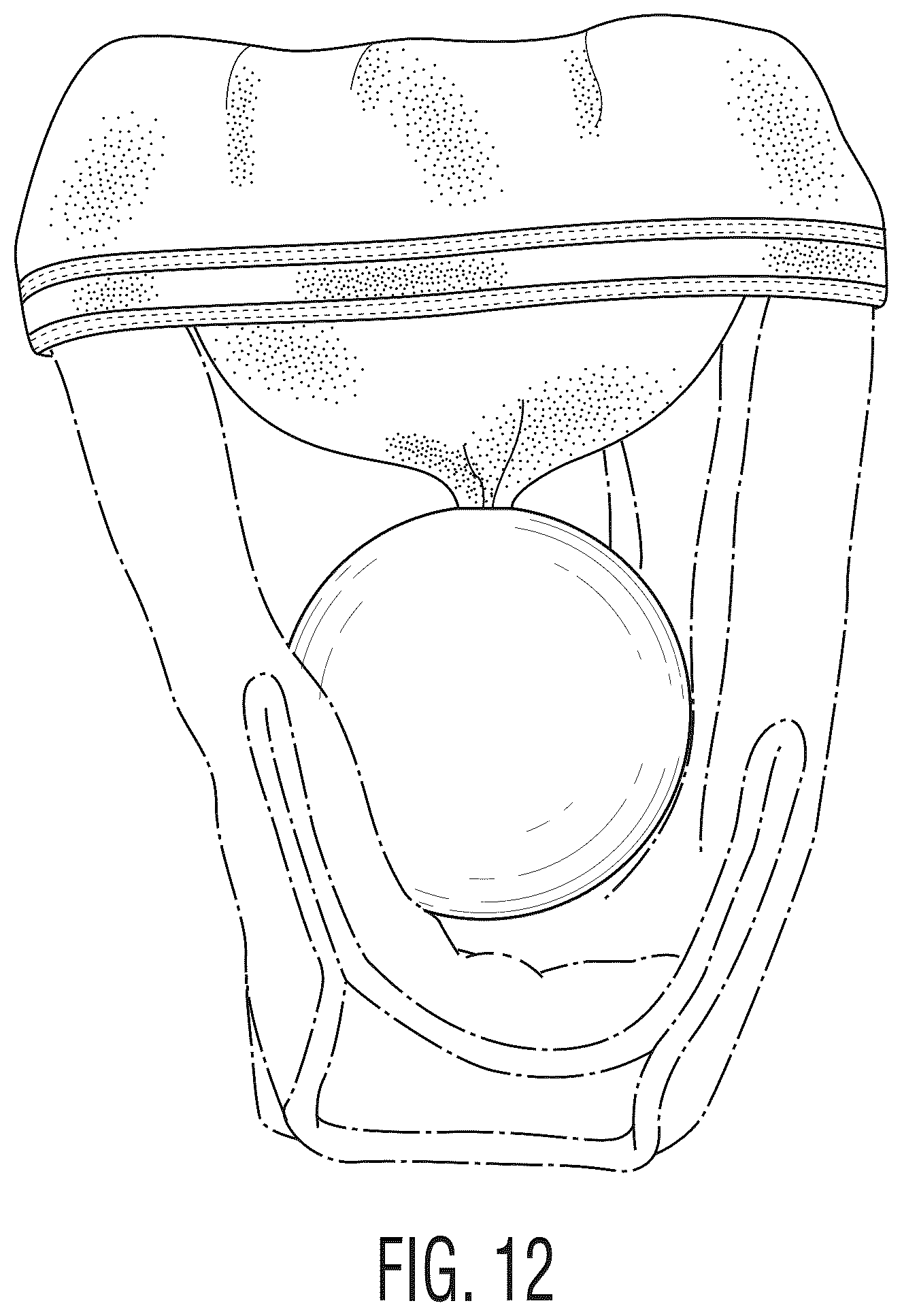Patent USD1043879 Figure 11 – Baseball glove protector and pocket shaper apparatus