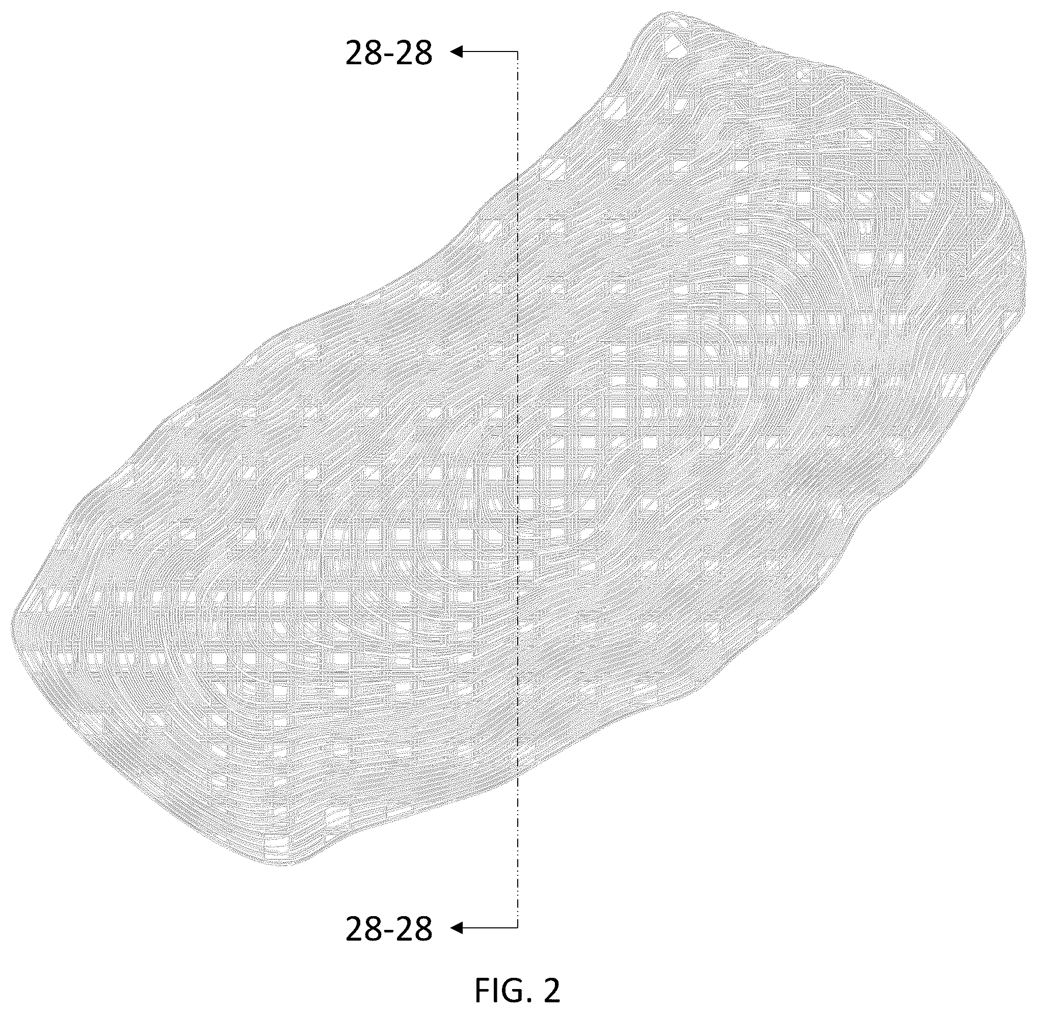 Patent USD1043985 Figure 2 – Chest implant