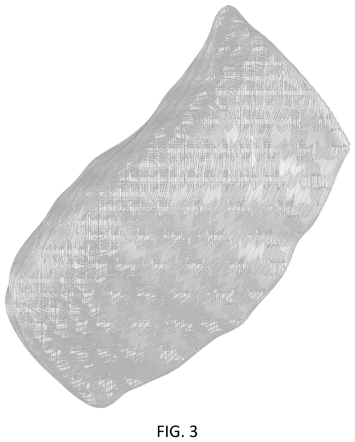 Patent USD1043985 Figure 3 – Chest implant