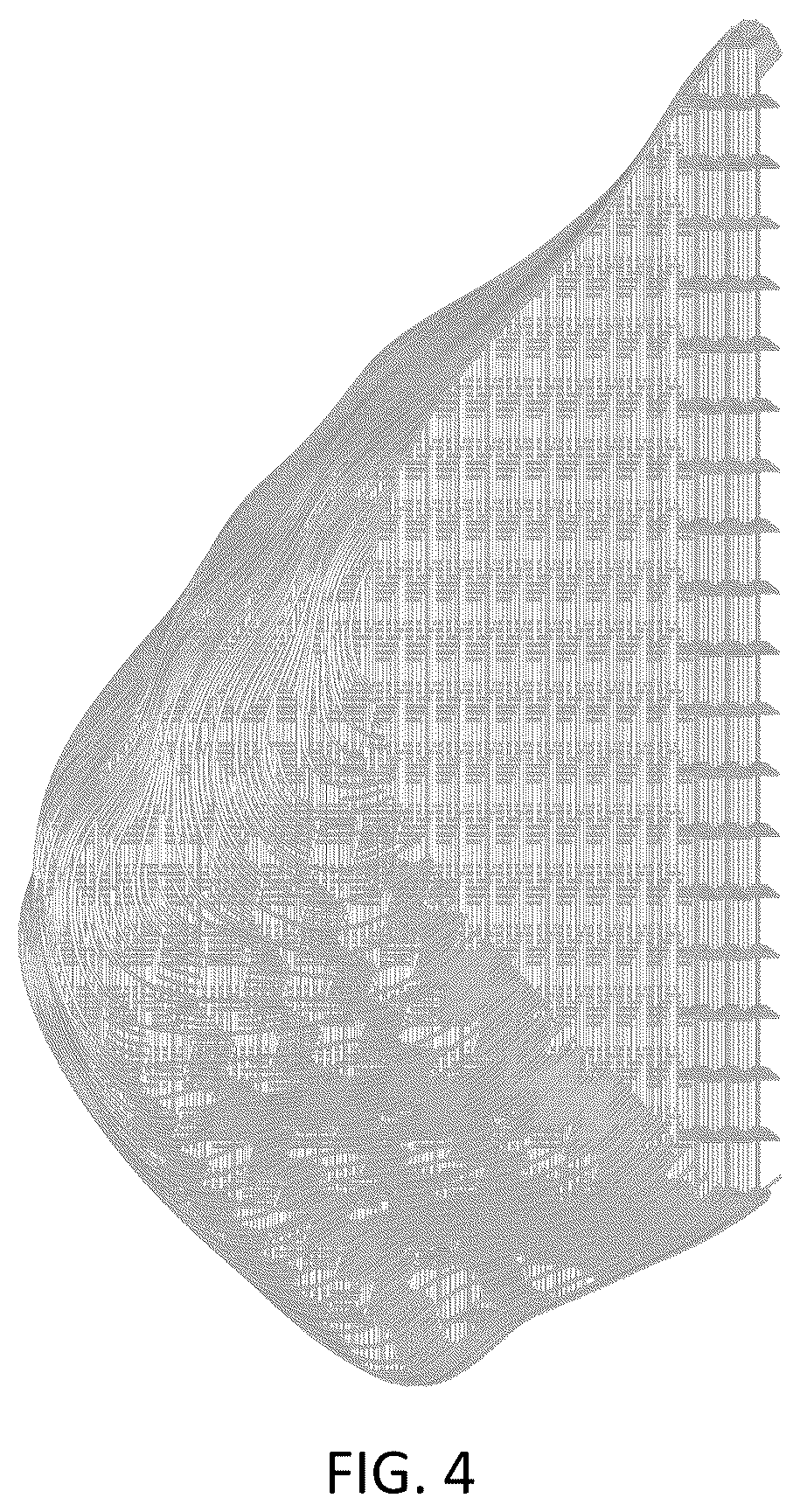 Patent USD1043985 Figure 4 – Chest implant