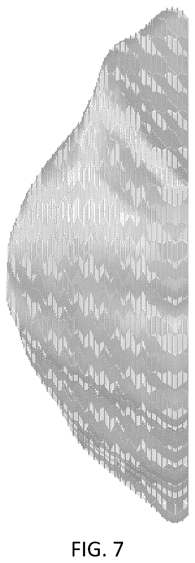Patent USD1043985 Figure 7 – Chest implant