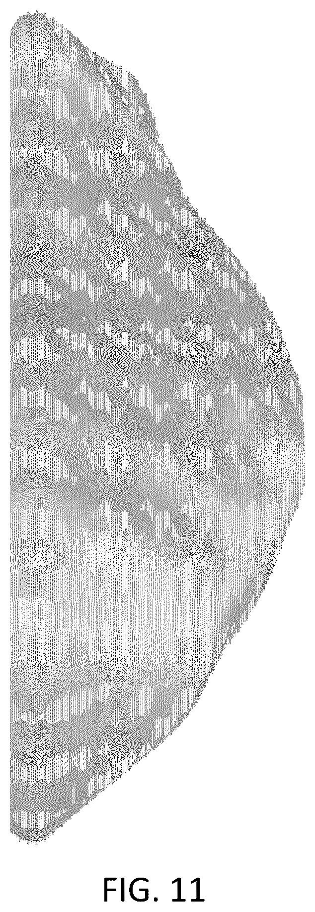 Patent USD1043985 Figure 11 – Chest implant
