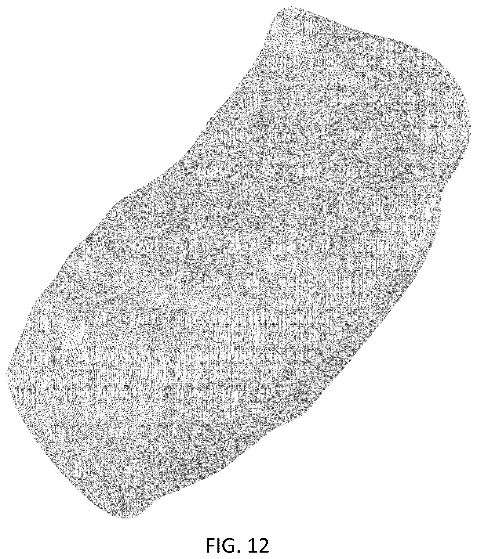 Patent USD1043985 Figure 12 – Chest implant