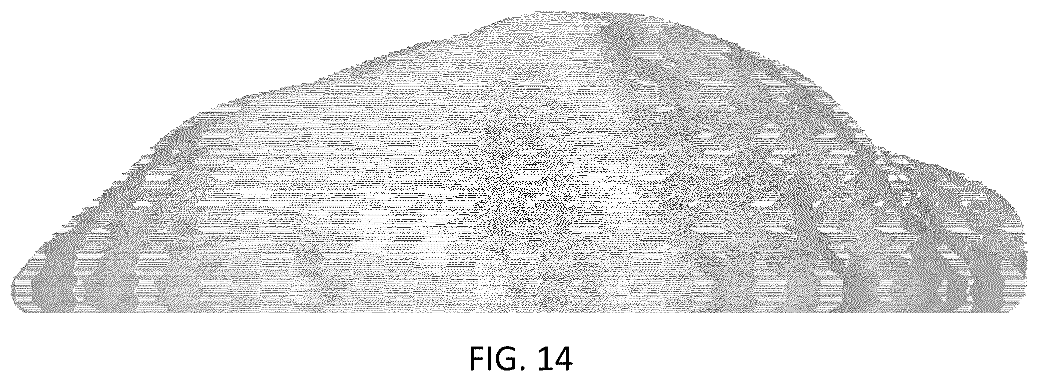 Patent USD1043985 Figure 14 – Chest implant
