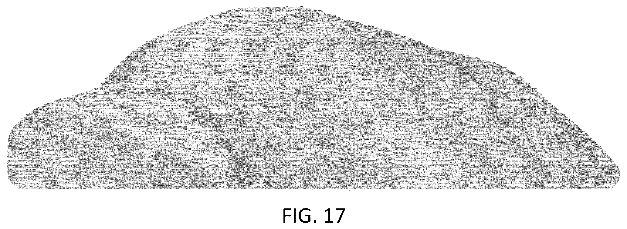 Patent USD1043985 Figure 17 – Chest implant
