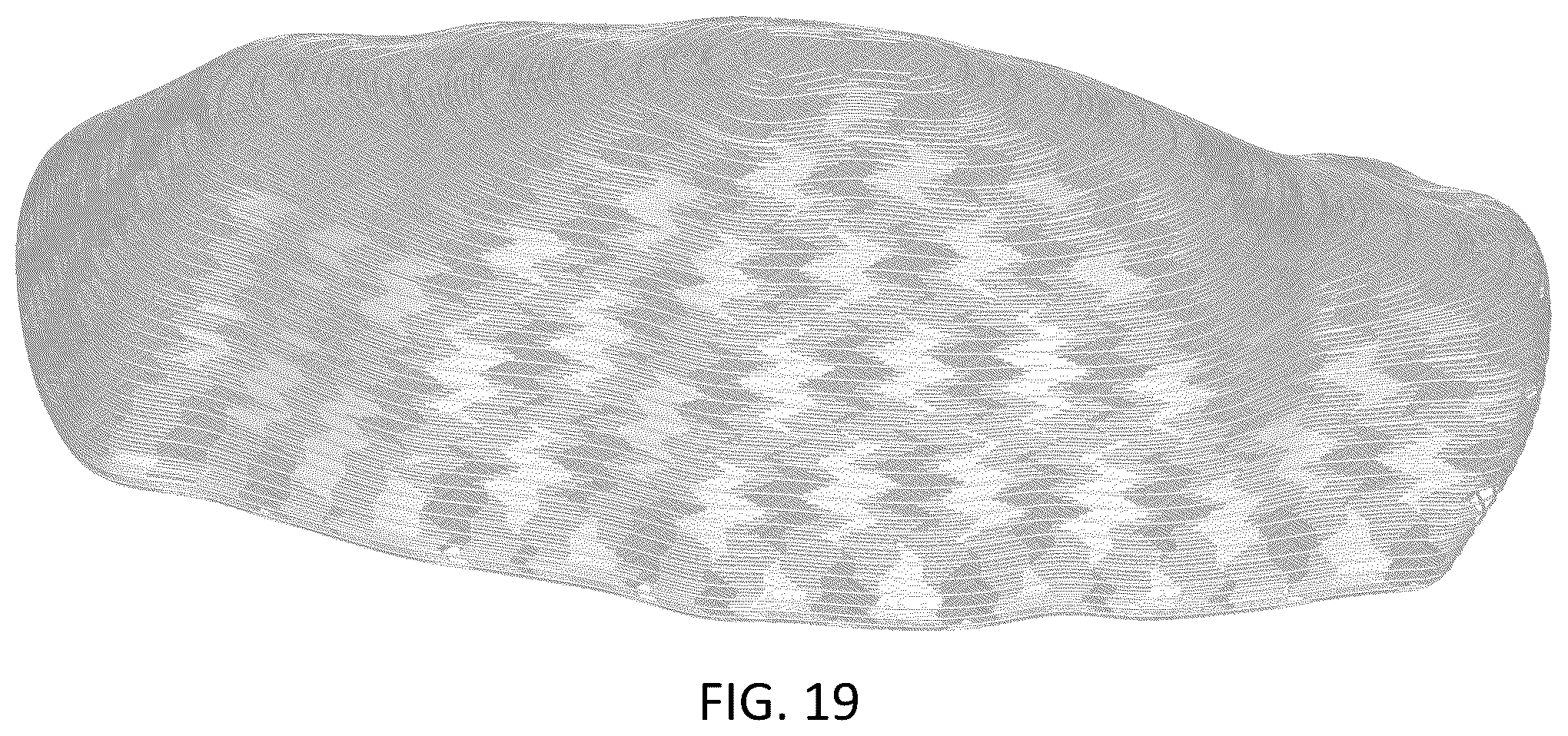 Patent USD1043985 Figure 19 – Chest implant