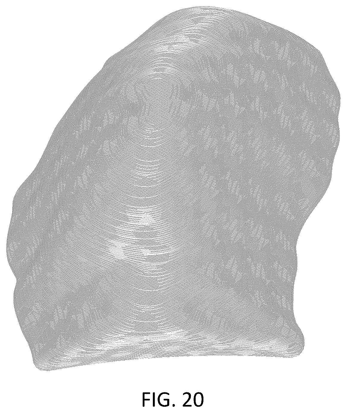 Patent USD1043985 Figure 20 – Chest implant