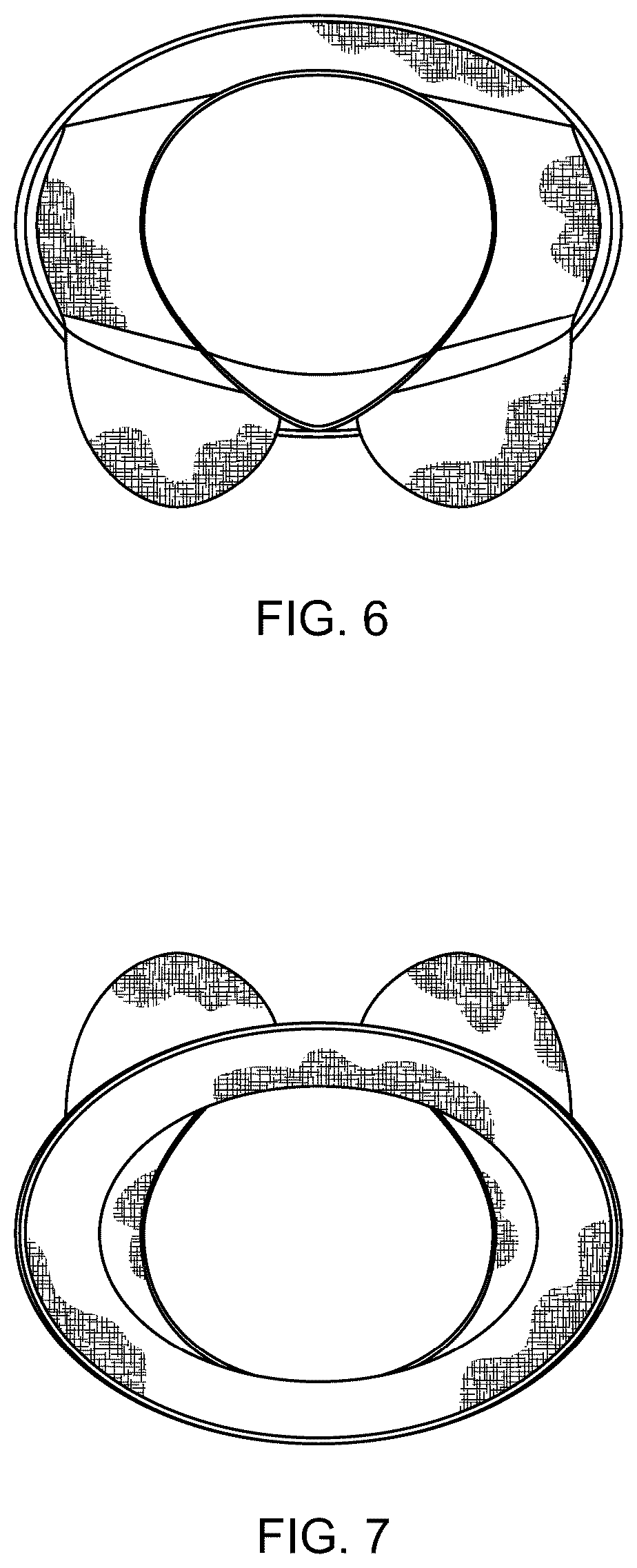 Patent USD1044204 Figure 5 – Girdle