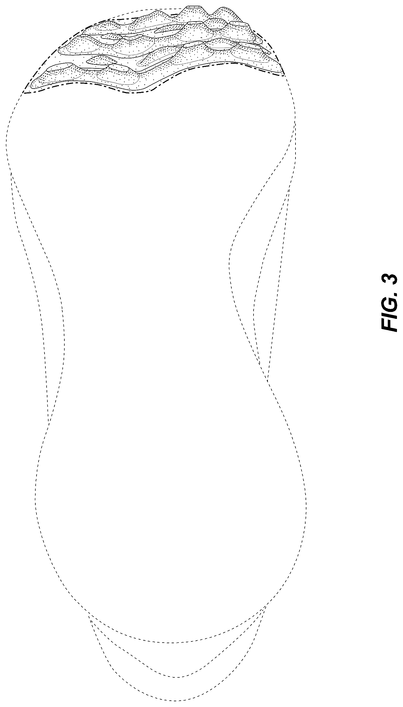 Patent USD1044238 Figure 3 – Shoe