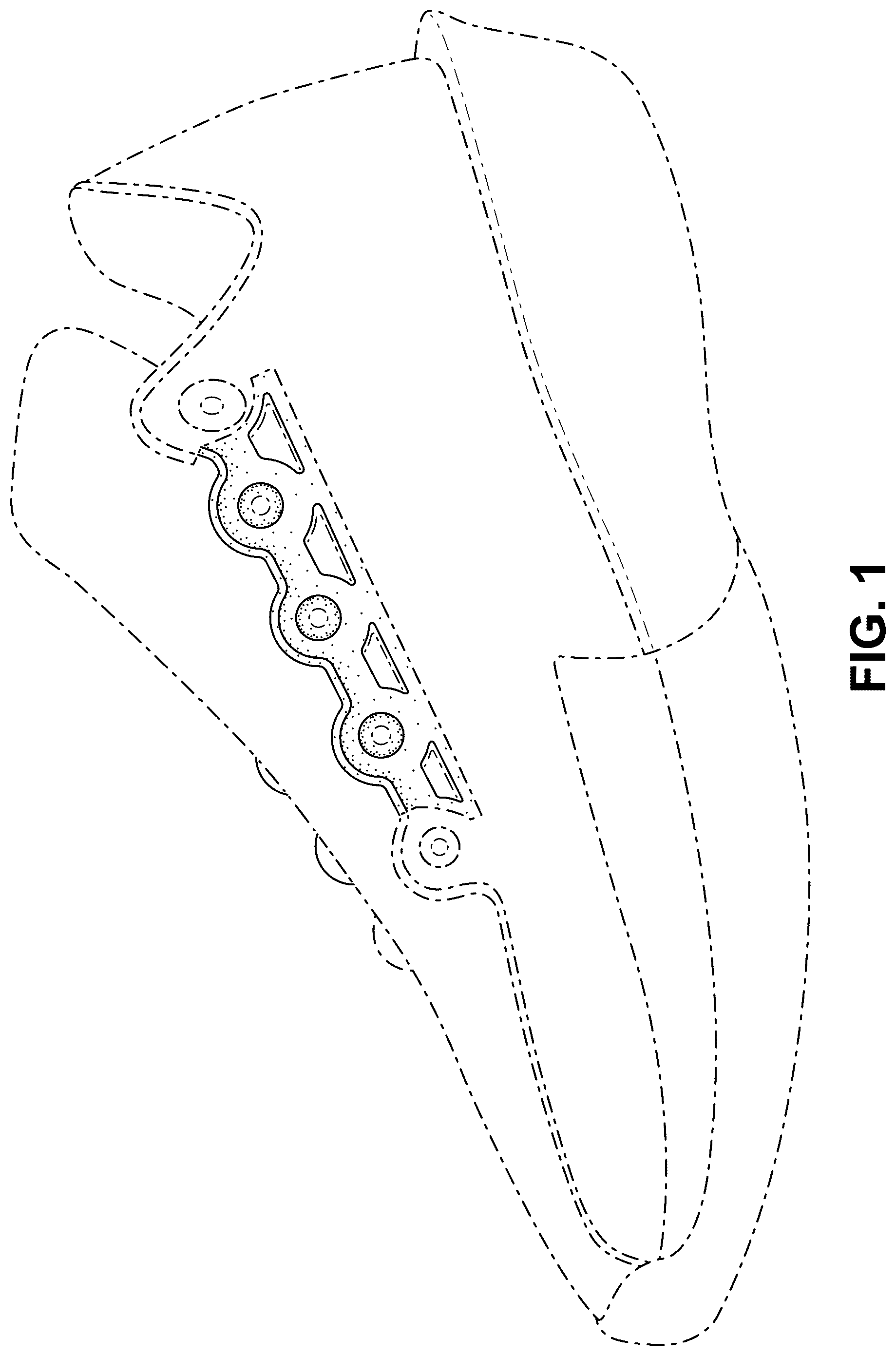 Patent USD1044252 Figure 1 – Shoe