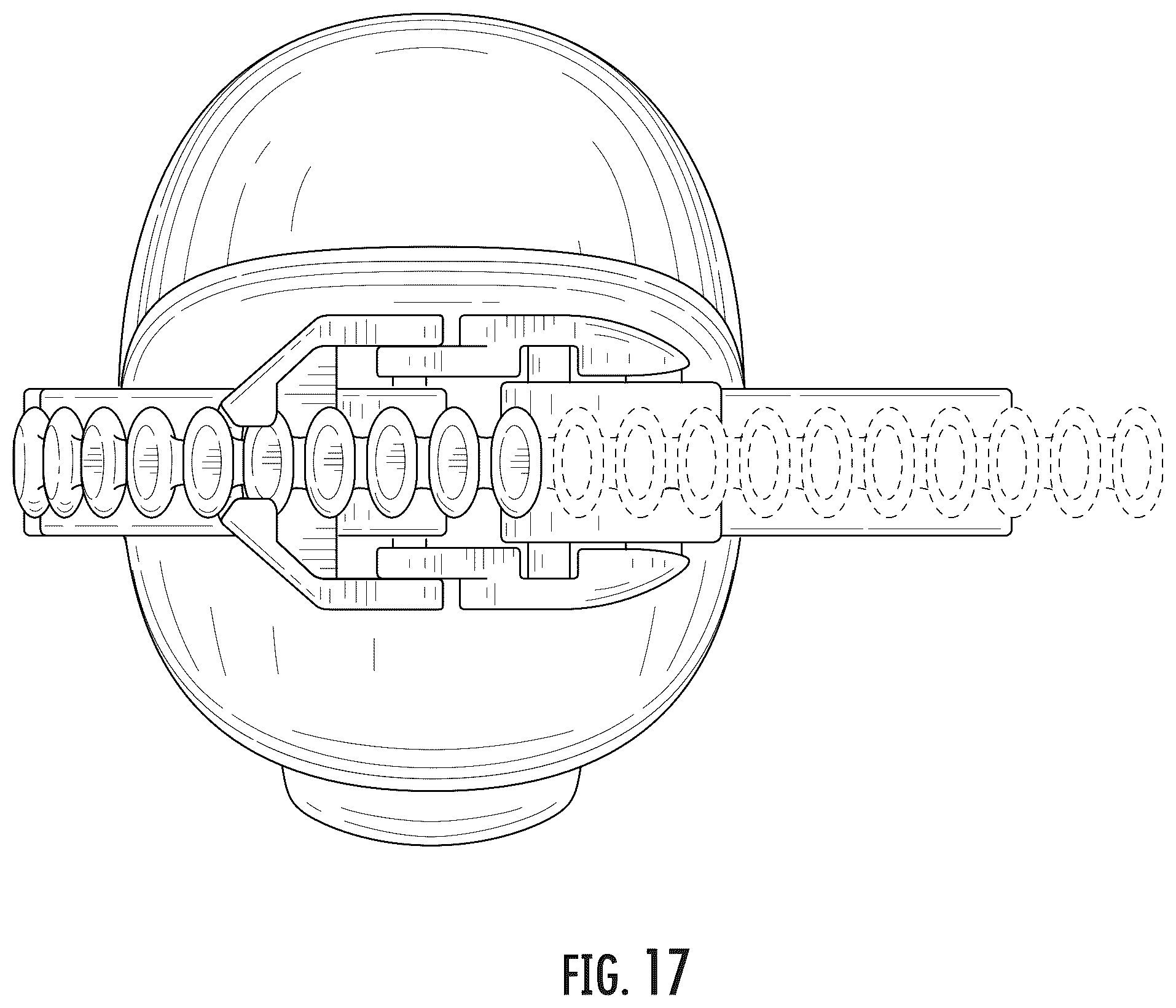 Patent USD1045097 Figure 17 – Wrist brace