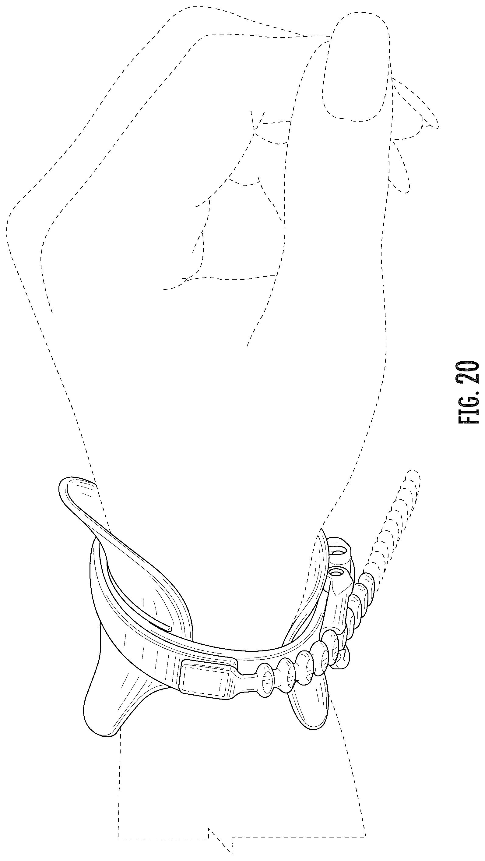 Patent USD1045097 Figure 20 – Wrist brace