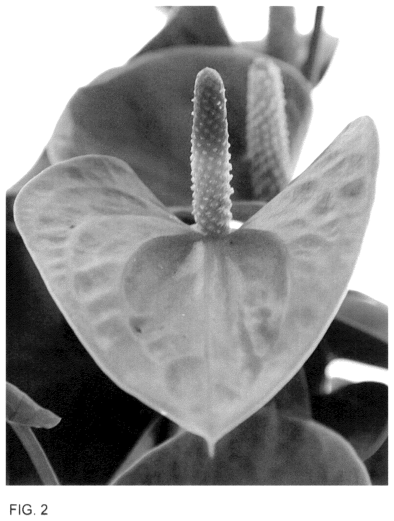 Patent USPP036290 Figure 2 – Anthurium plant named ‘AN2631609’