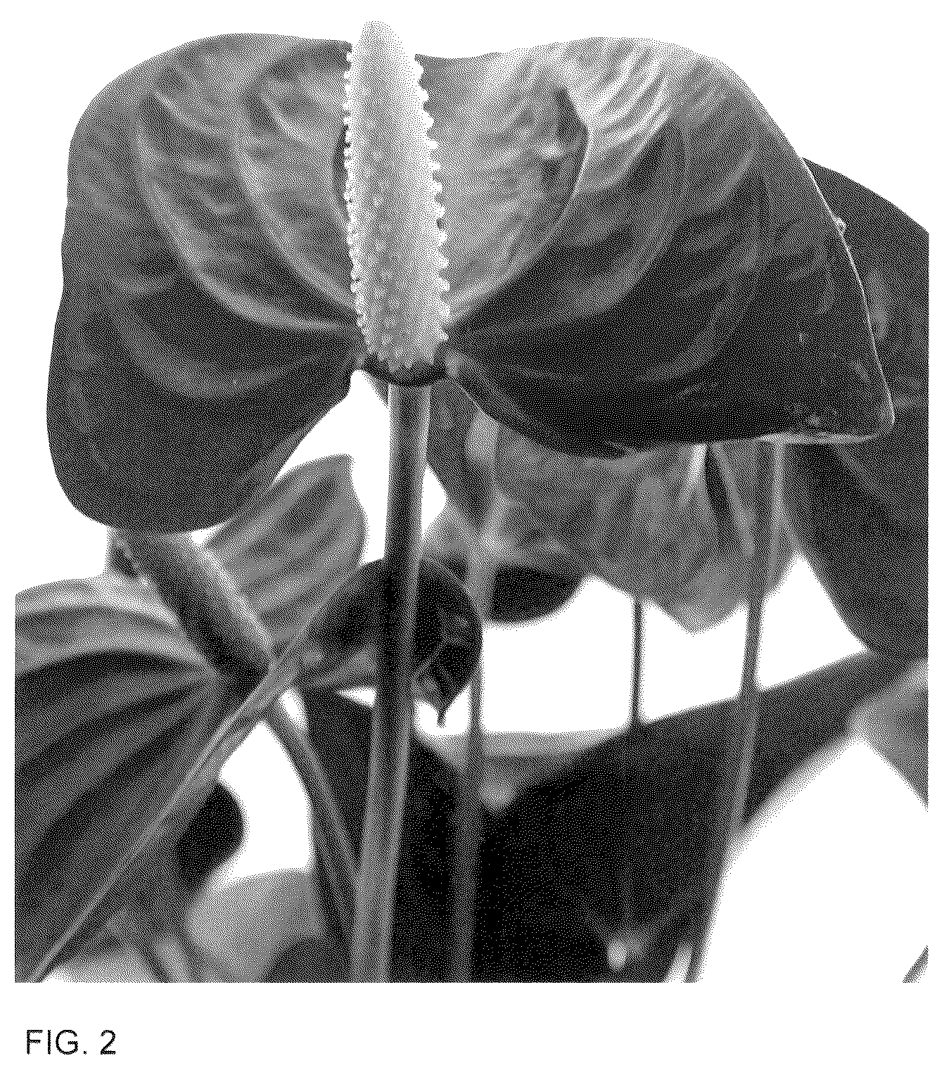 Patent USPP036291 Figure 2 – Anthurium plant named ‘AN2824056’