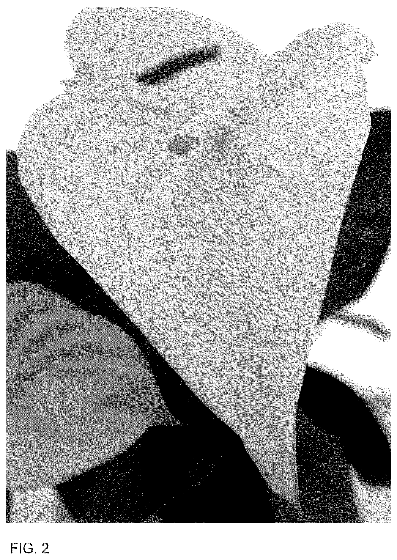 Patent USPP036292 Figure 2 – Anthurium plant named ‘AN2824663’