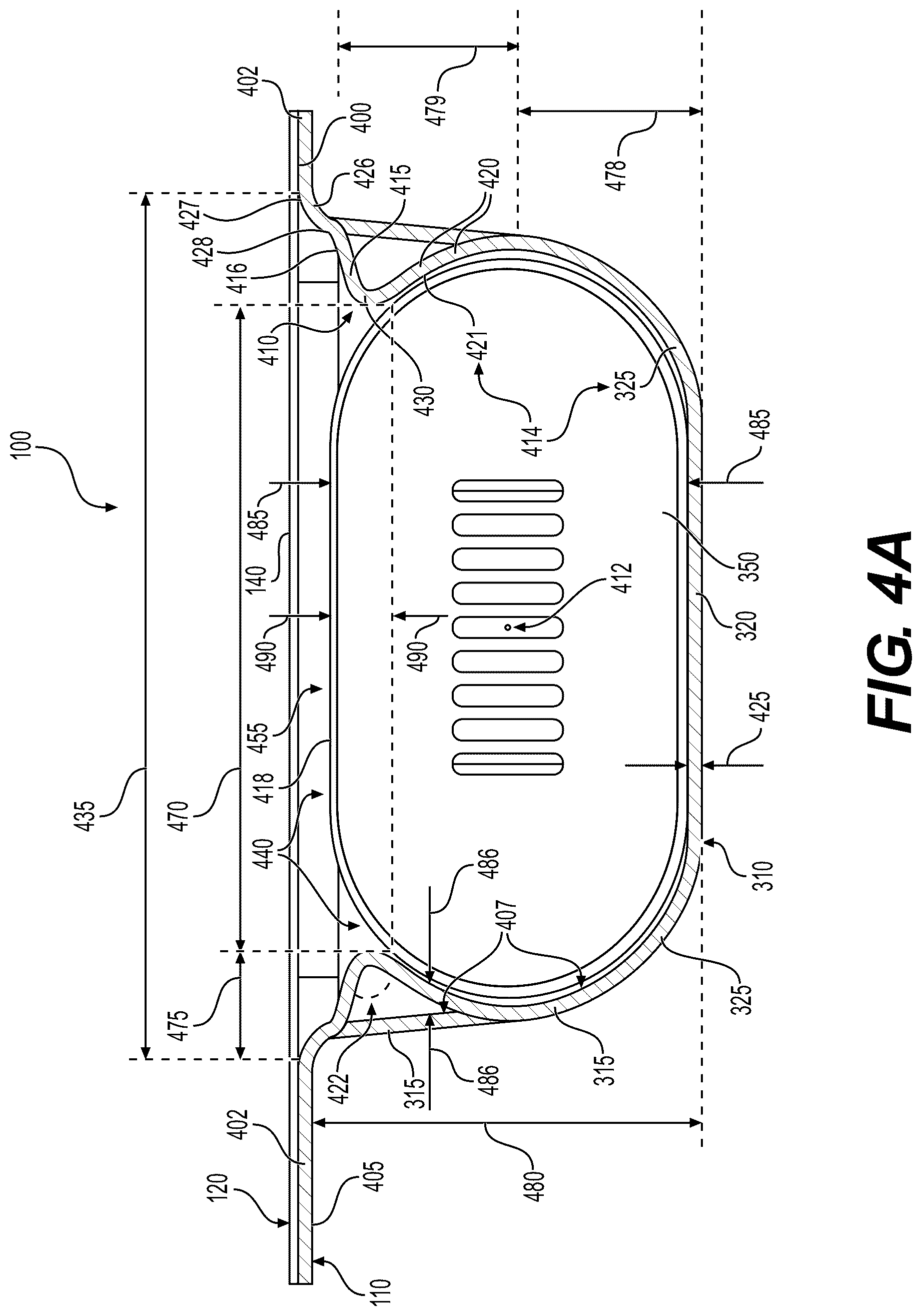 Patent US12297022 Figure 4 – Insert with undercuts