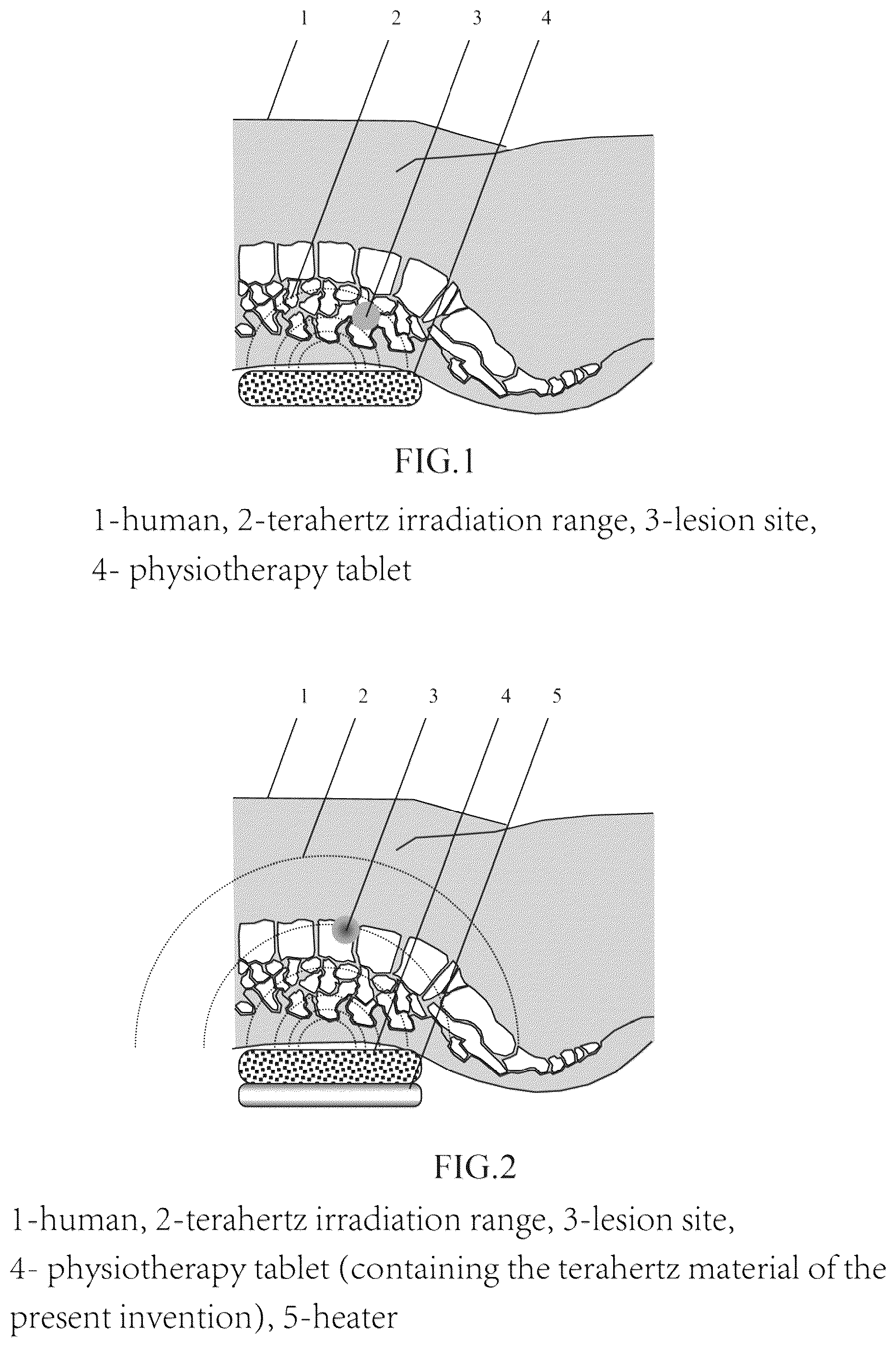 Patent US12297114 Figure 1 – Terahertz material with therapeutic and health care effect and its preparation method and application