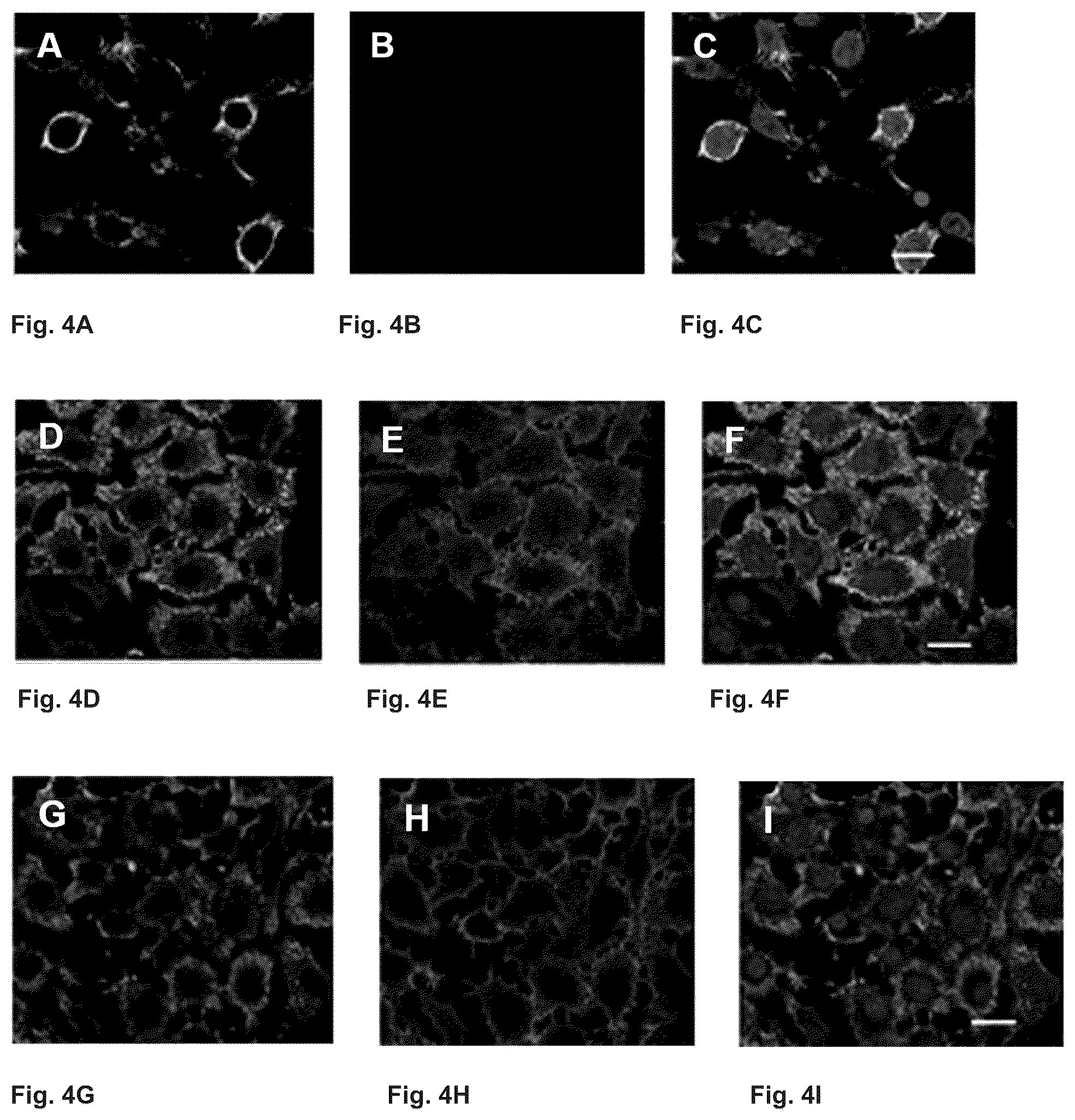 Patent US12297237 Figure 2 – Mutated glycoprotein of vesicular stomatitis virus