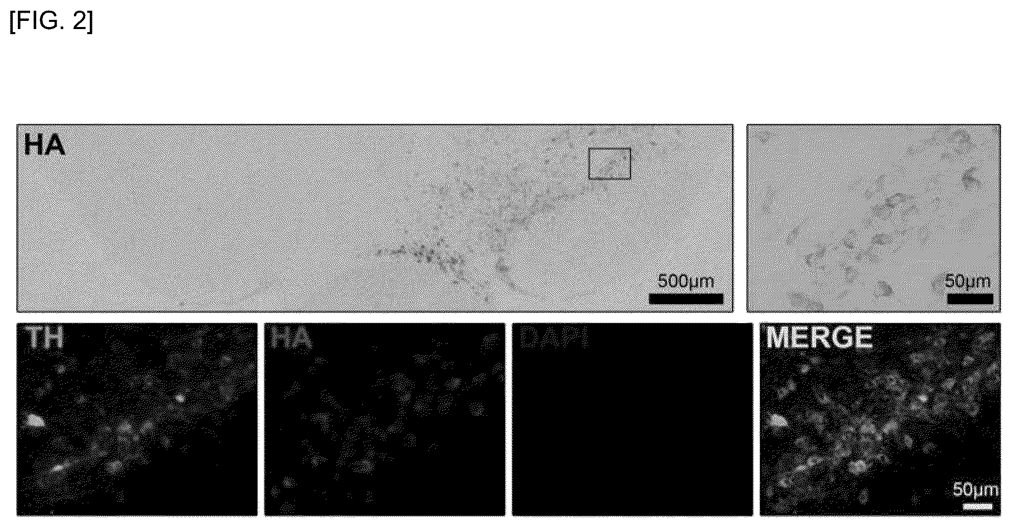 Patent US12297242 Figure 2 – Composition for preventing or treating Parkinson's disease, comprising AEG-1 S298D as active ingredient