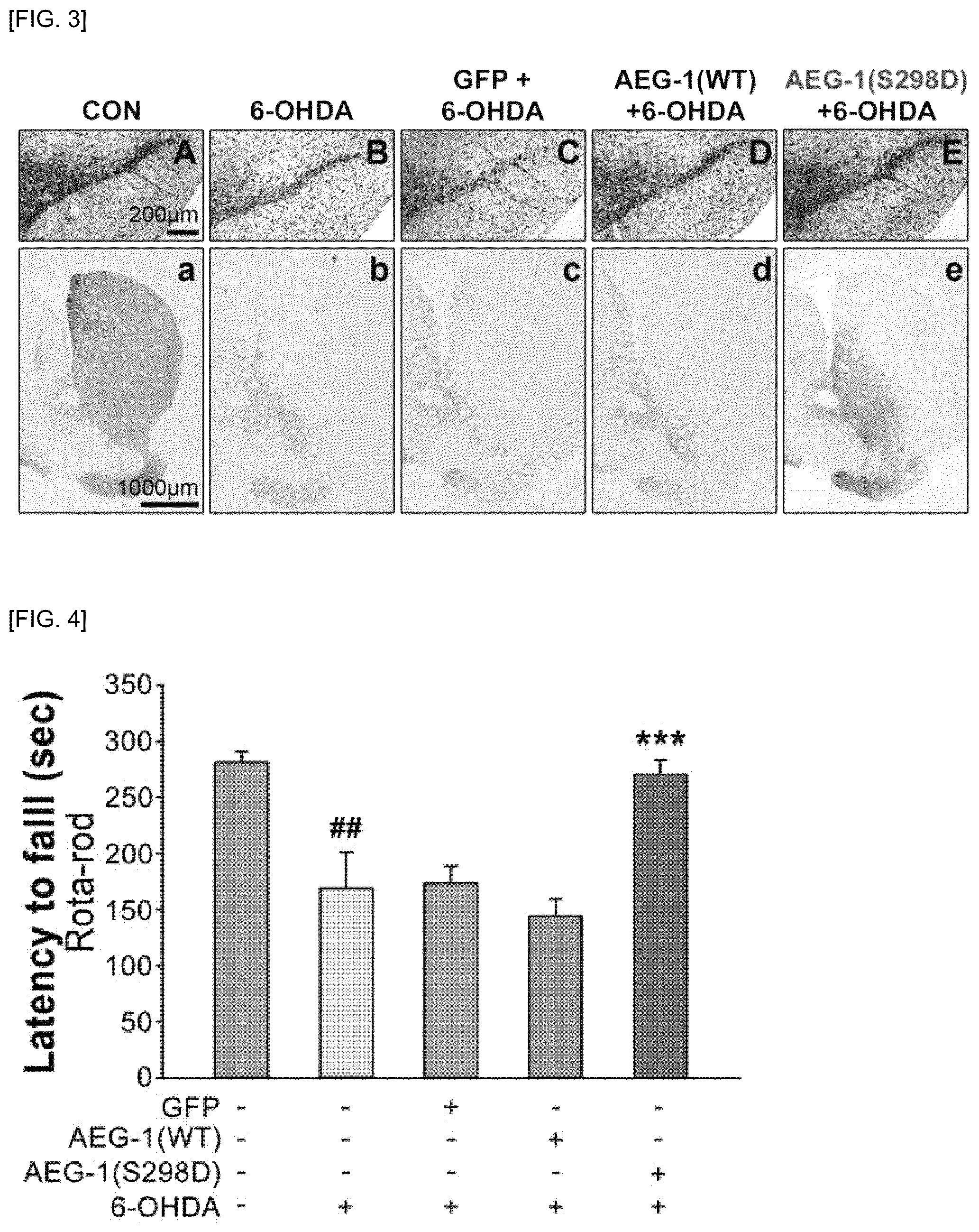 Patent US12297242 Figure 3 – Composition for preventing or treating Parkinson's disease, comprising AEG-1 S298D as active ingredient