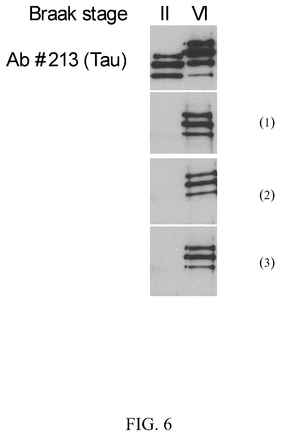 Patent US12297263 Figure 7 – Humanized anti-Tau(PS422) antibodies and methods of use