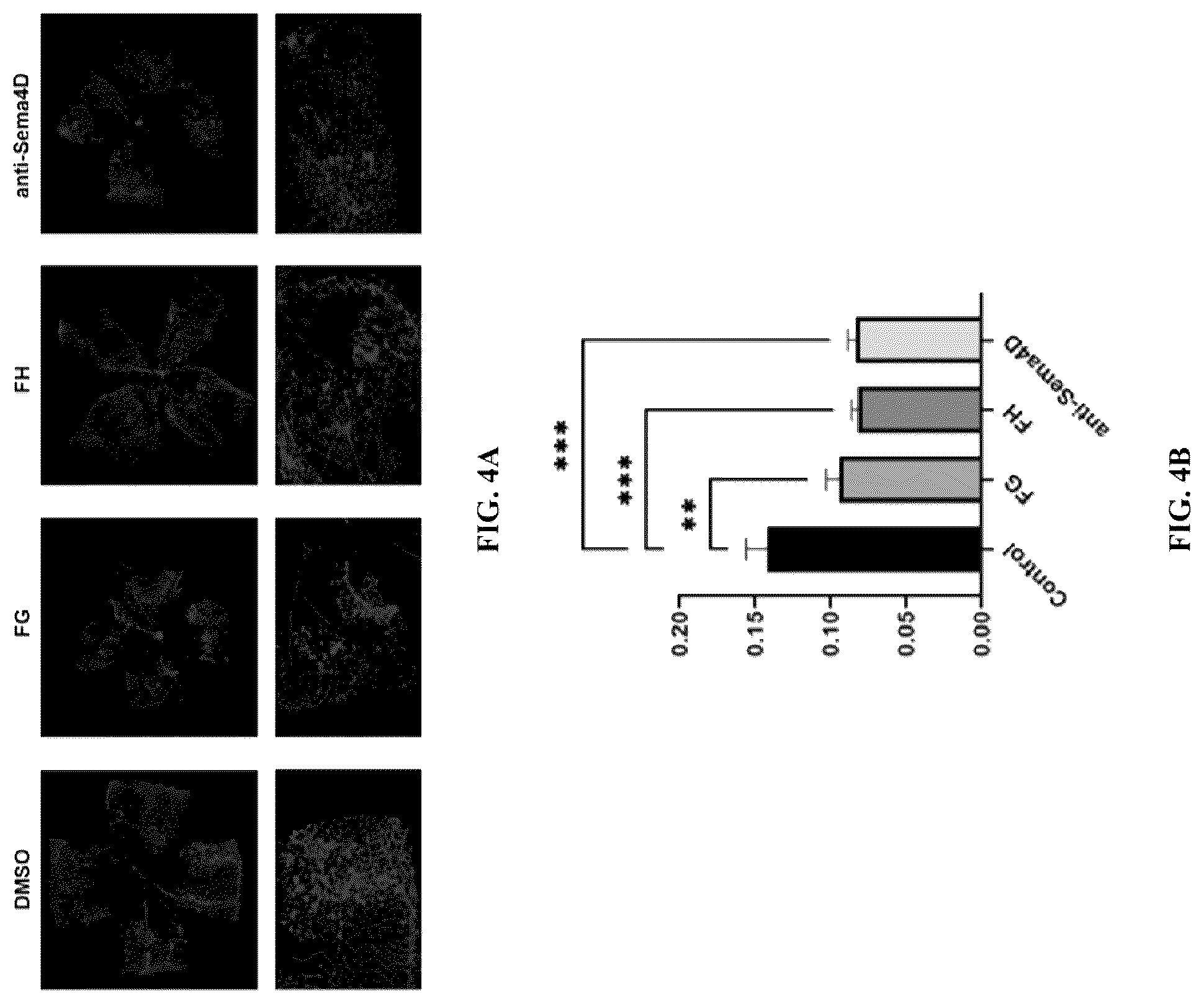 Patent US12297296 Figure 4 – Nano small peptide and its use in preparation of drugs for treating and preventing fundus vascular diseases