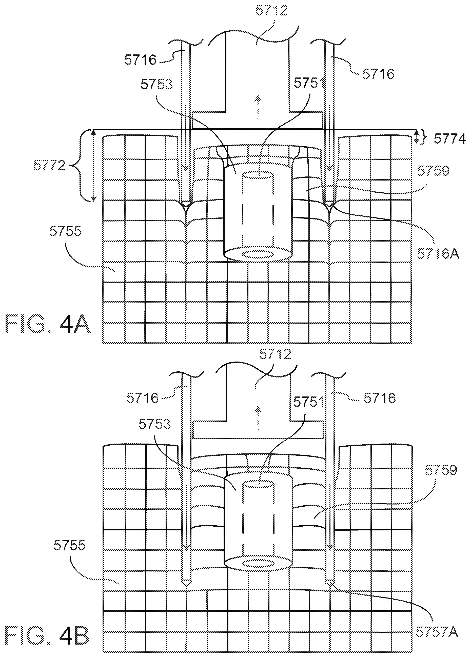 Patent US12297416 Figure 16 – System and method for transferring tissue